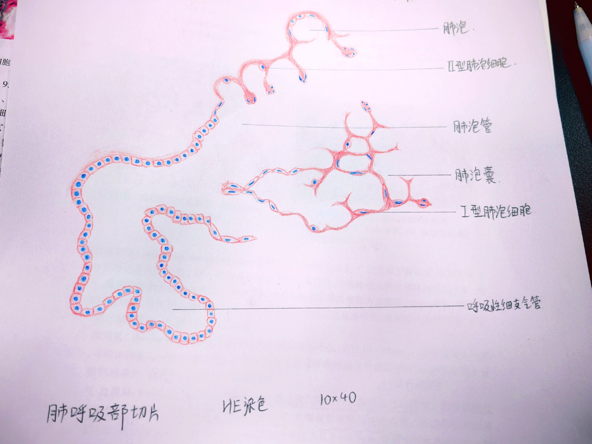 肺水肿红蓝铅笔图片