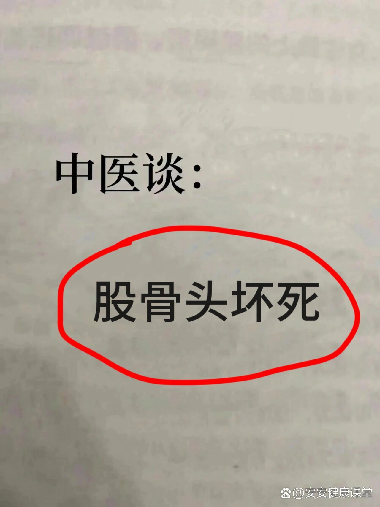 股骨头坏死4字测试法图片