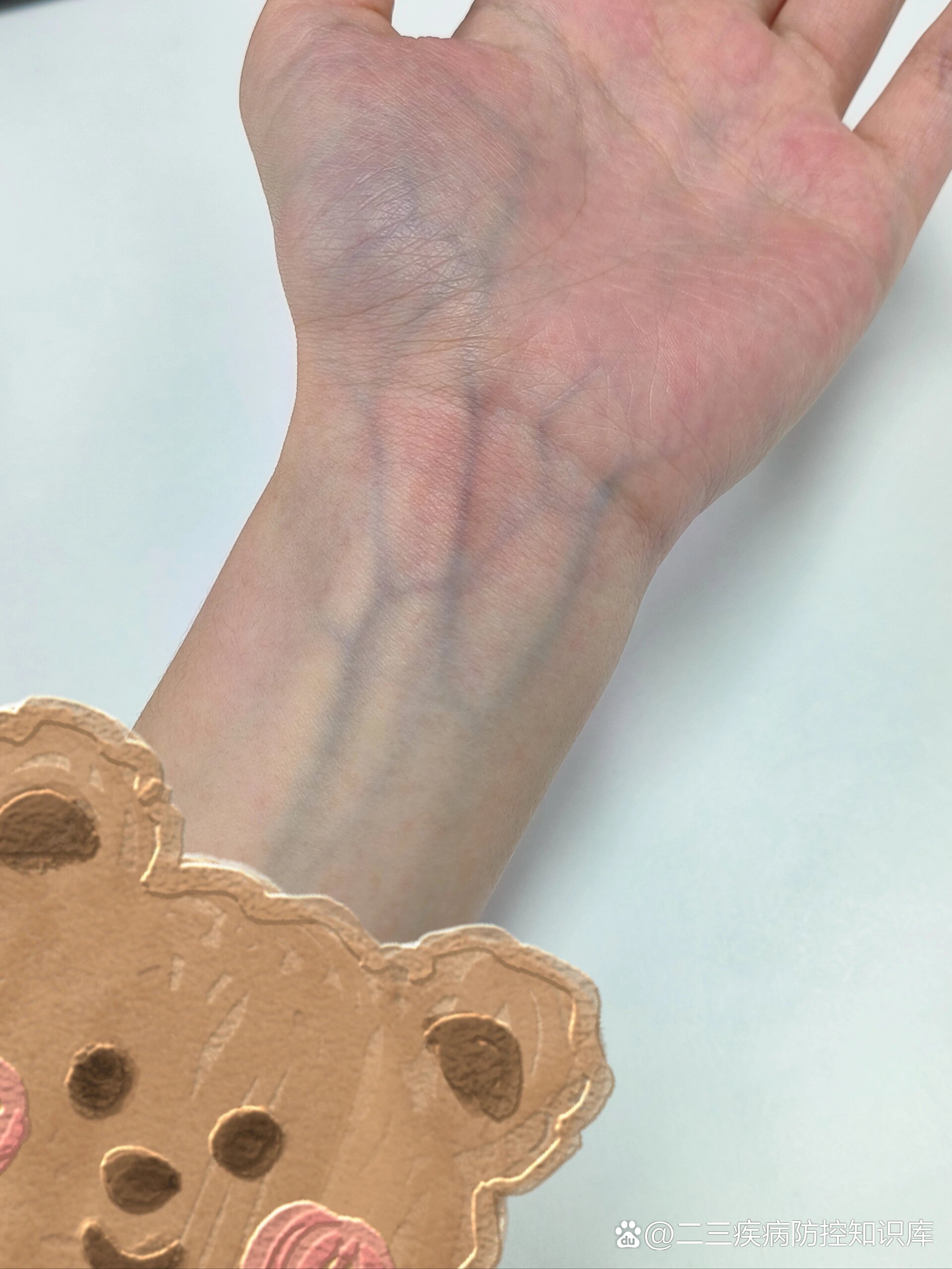 我的手腕血管好明显!