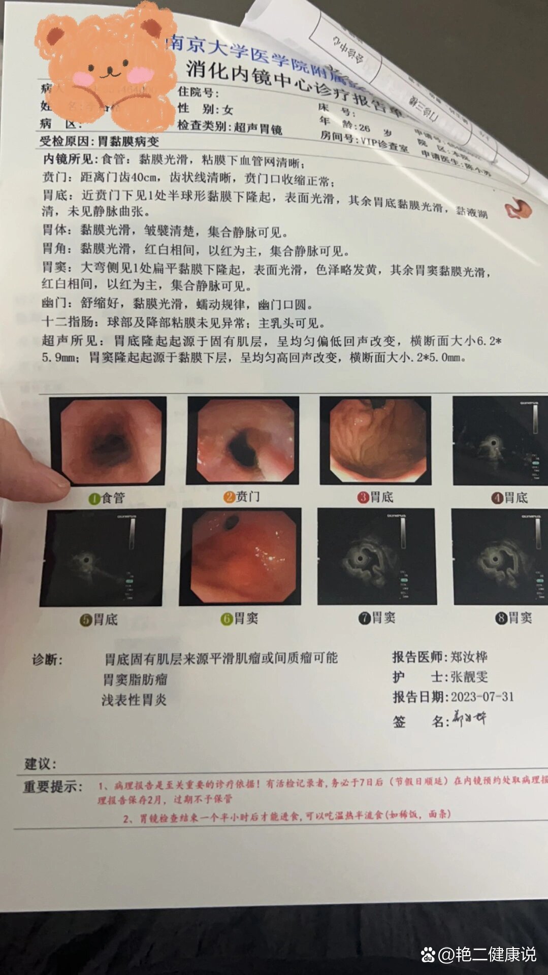 脂肪瘤有没有事啊 这个大小的间质瘤或者平滑肌瘤要立即手