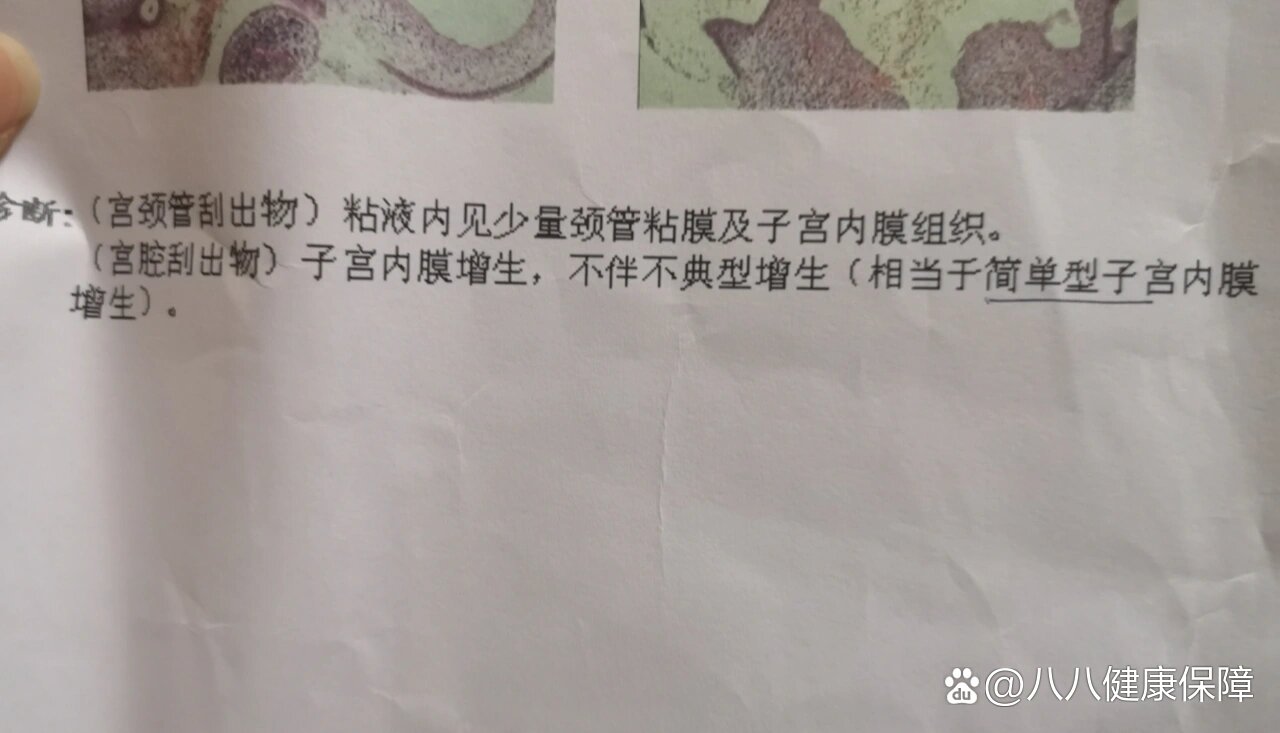 子宫内膜厚诊刮真后悔图片