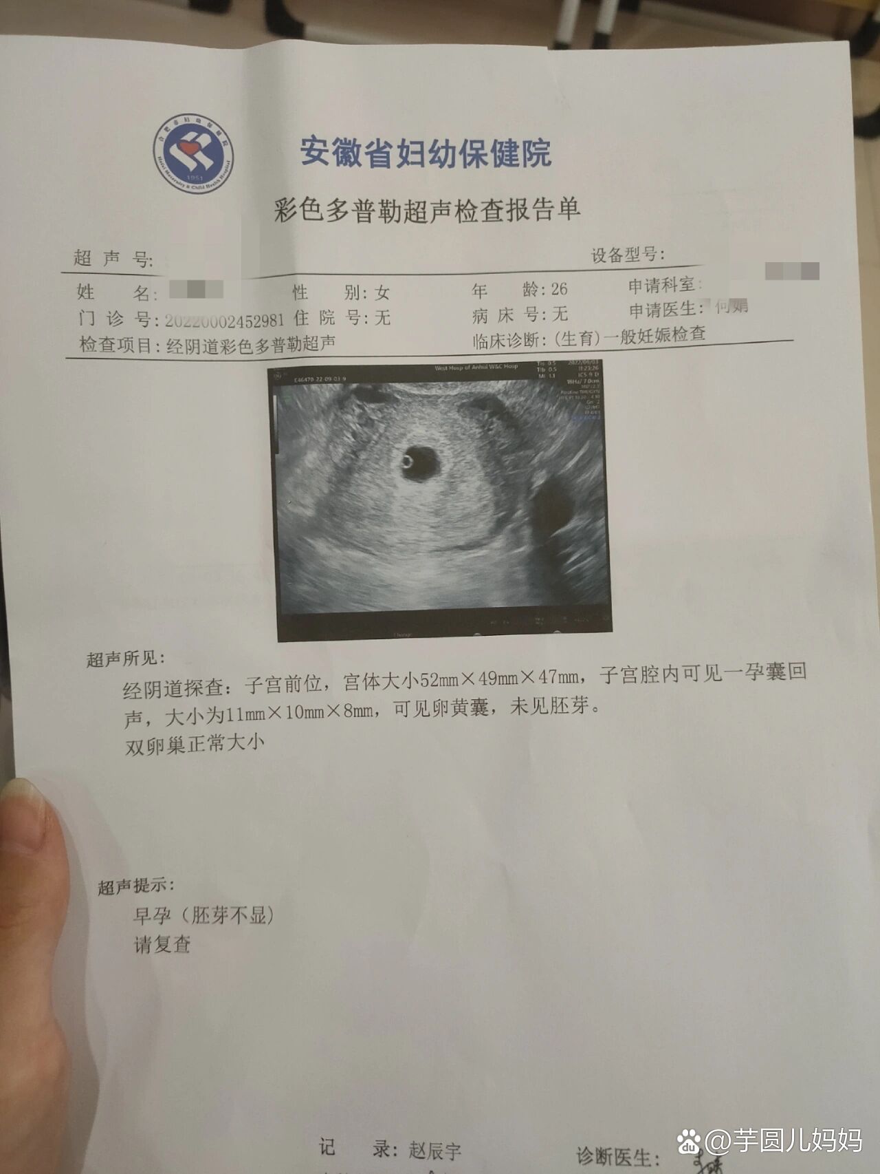 这个阴超能看出几周我按照算法好像才怀孕5周多唉