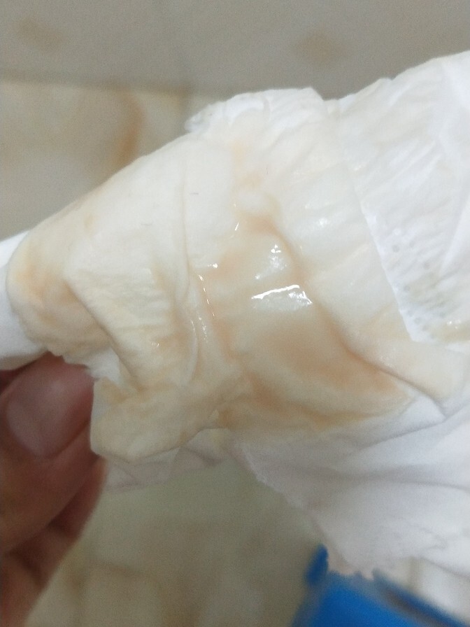 有图慎入,孕12周流分泌物