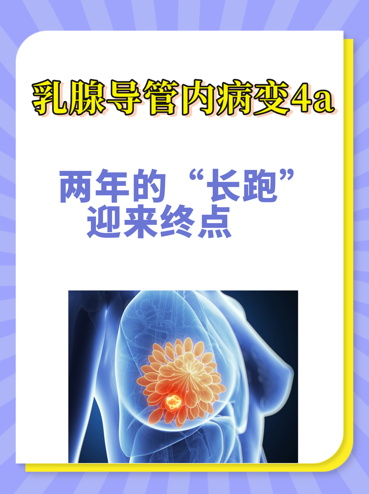 乳腺导管瘤 真人图片