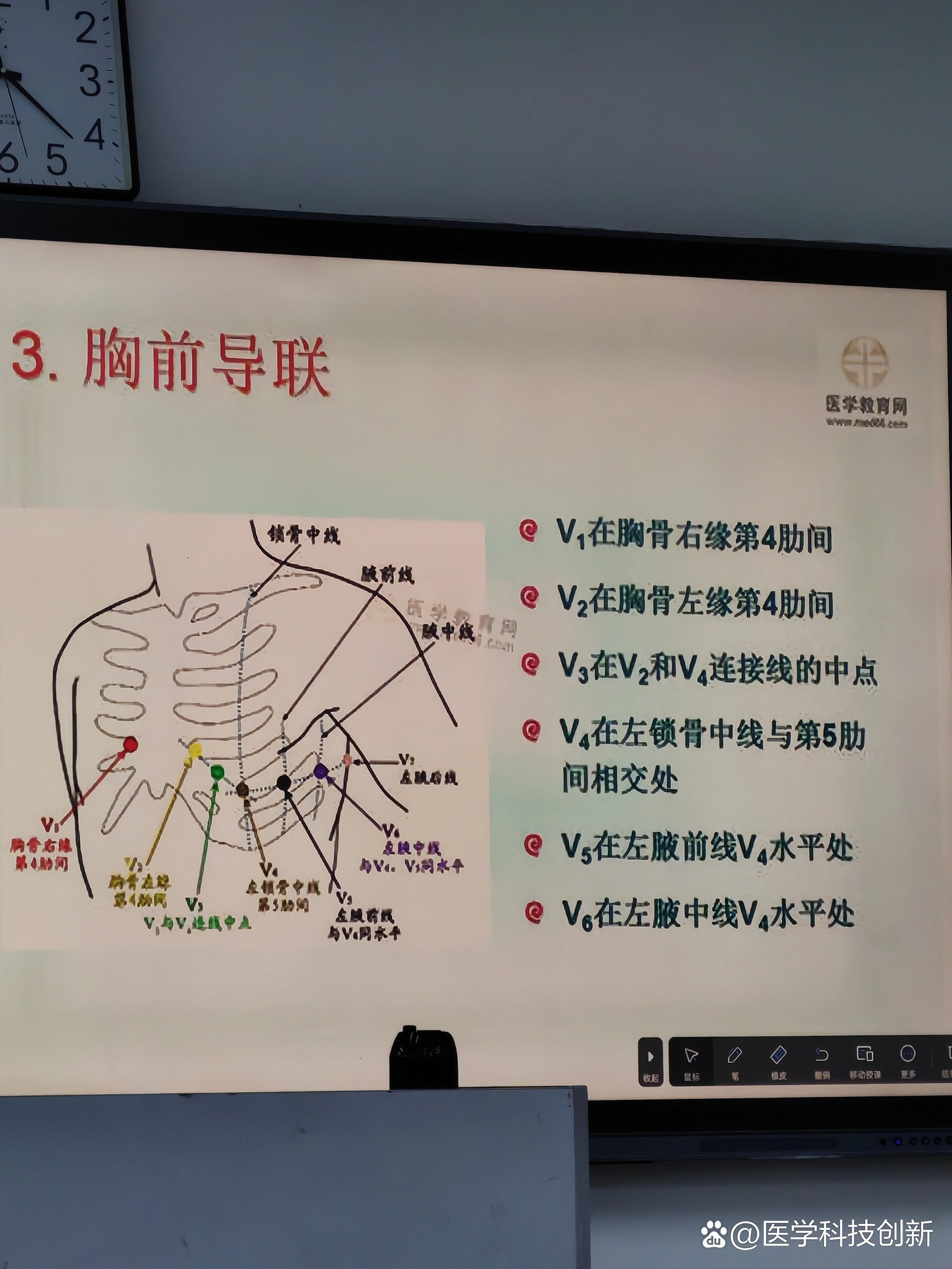 心电图6导联位置图片图片