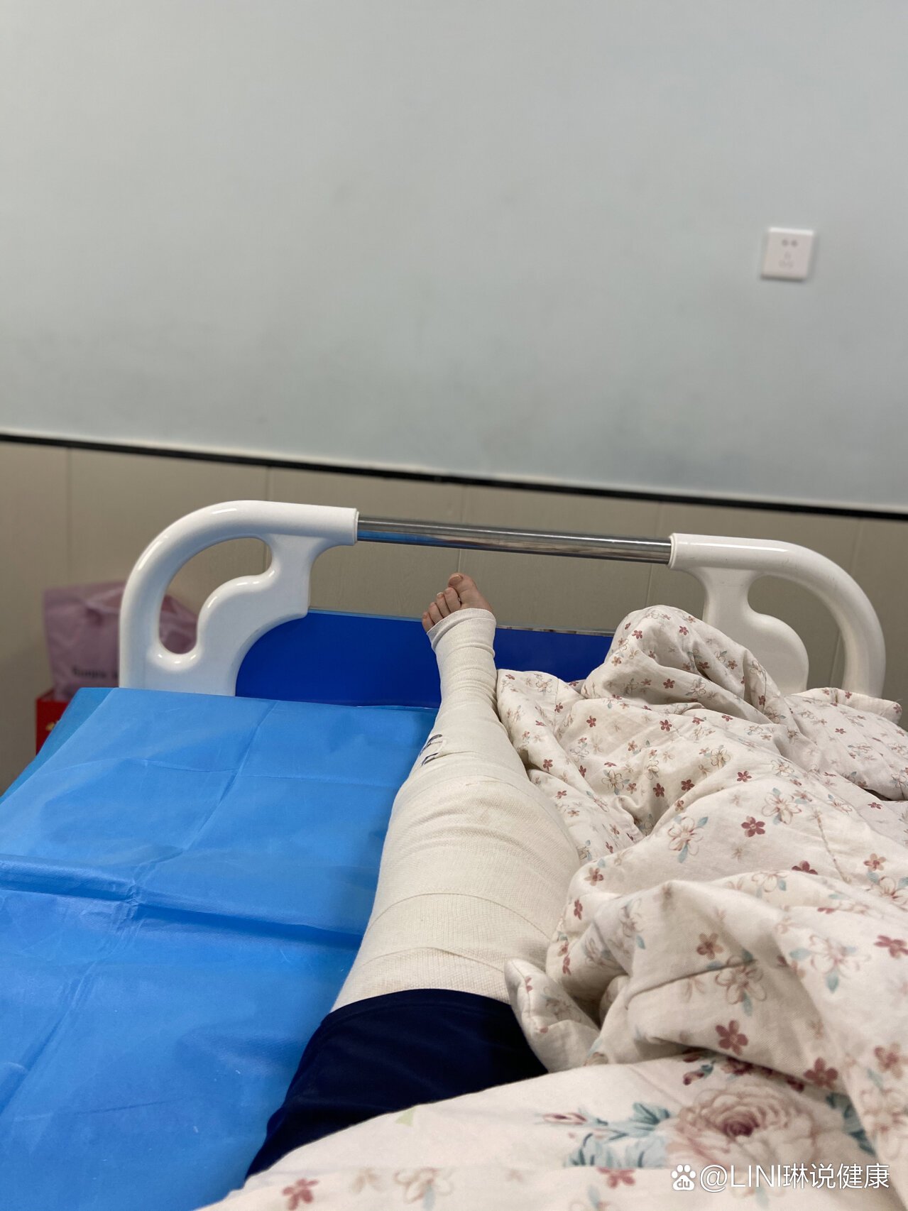 直流泪,嗷叫了几个小时,感觉镇痛泵也没什么用  br>这两天每天都换药