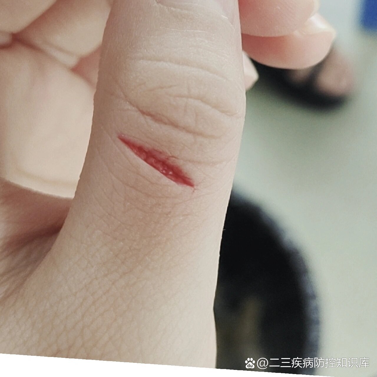 被割伤手真的很痛!