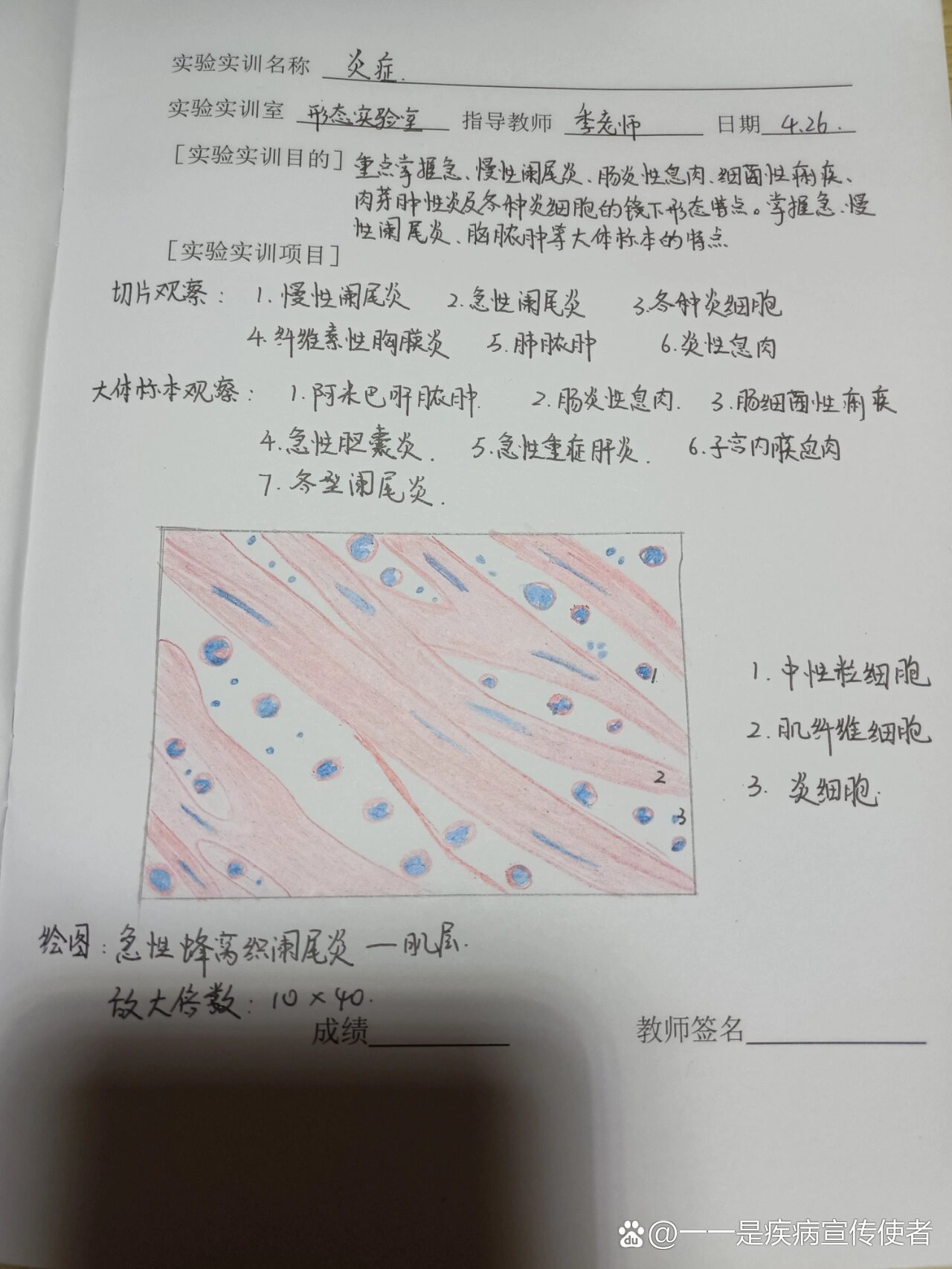 阑尾组织结构分层绘图图片