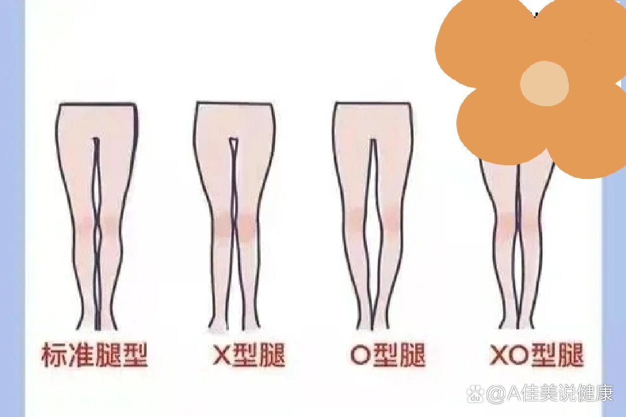 ox腿型图图片