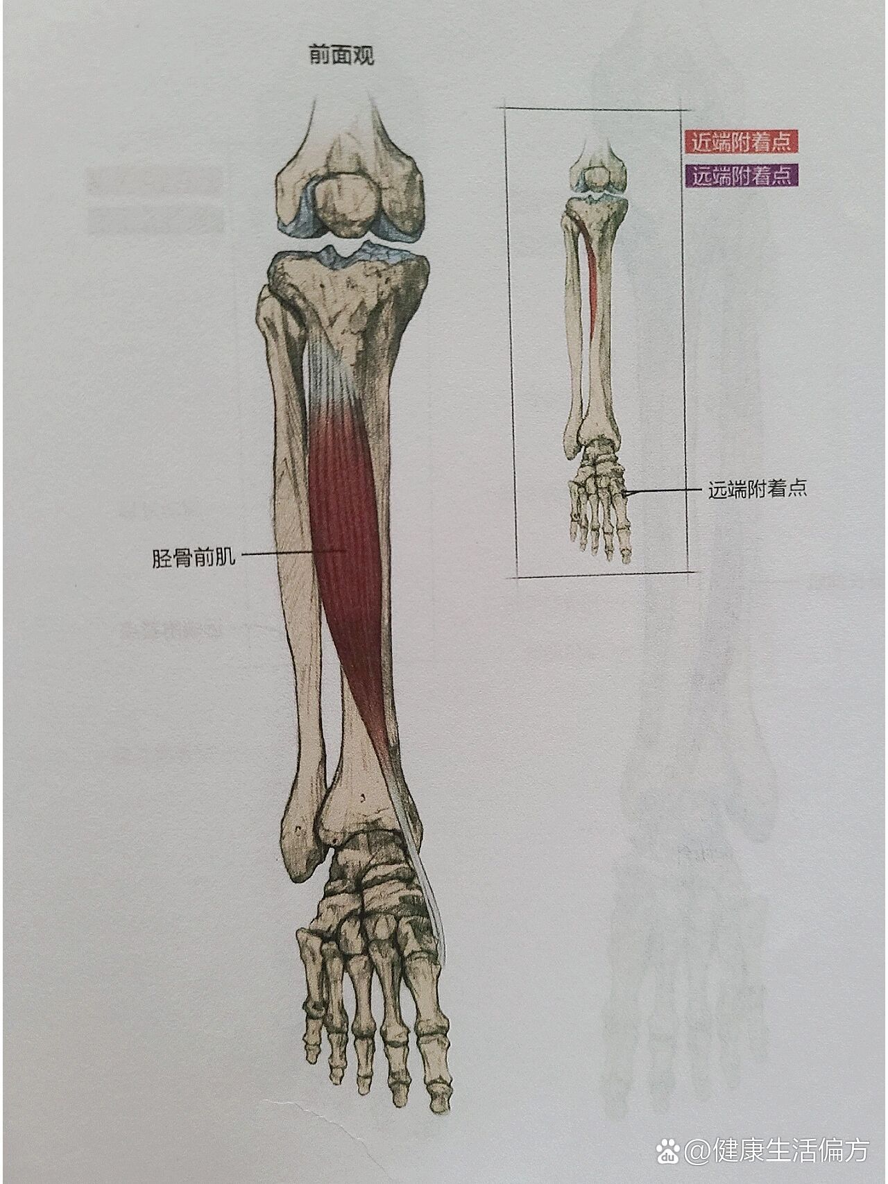 胫骨前肌紧张图片