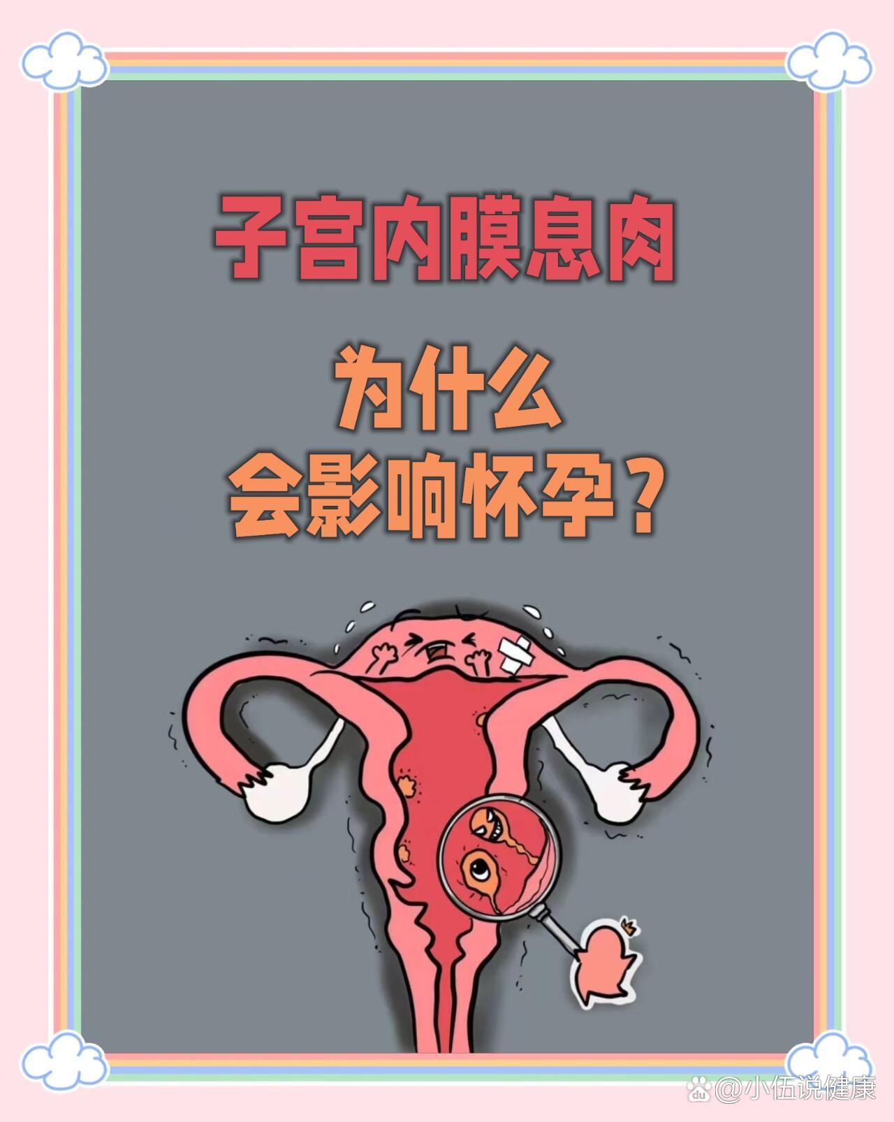 正常的子宫息肉图图片