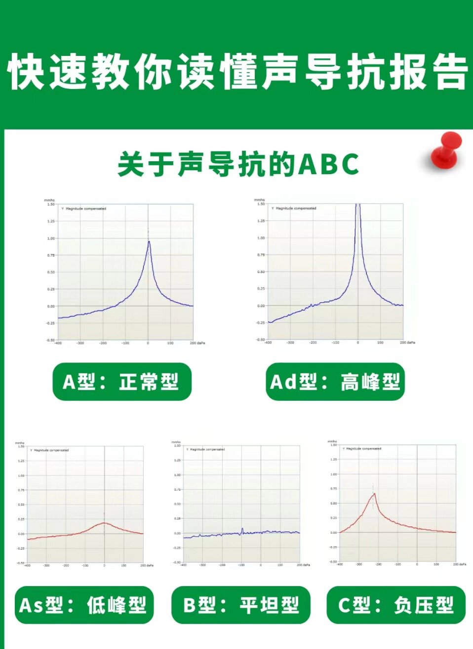 如何快速看懂声导抗报告单