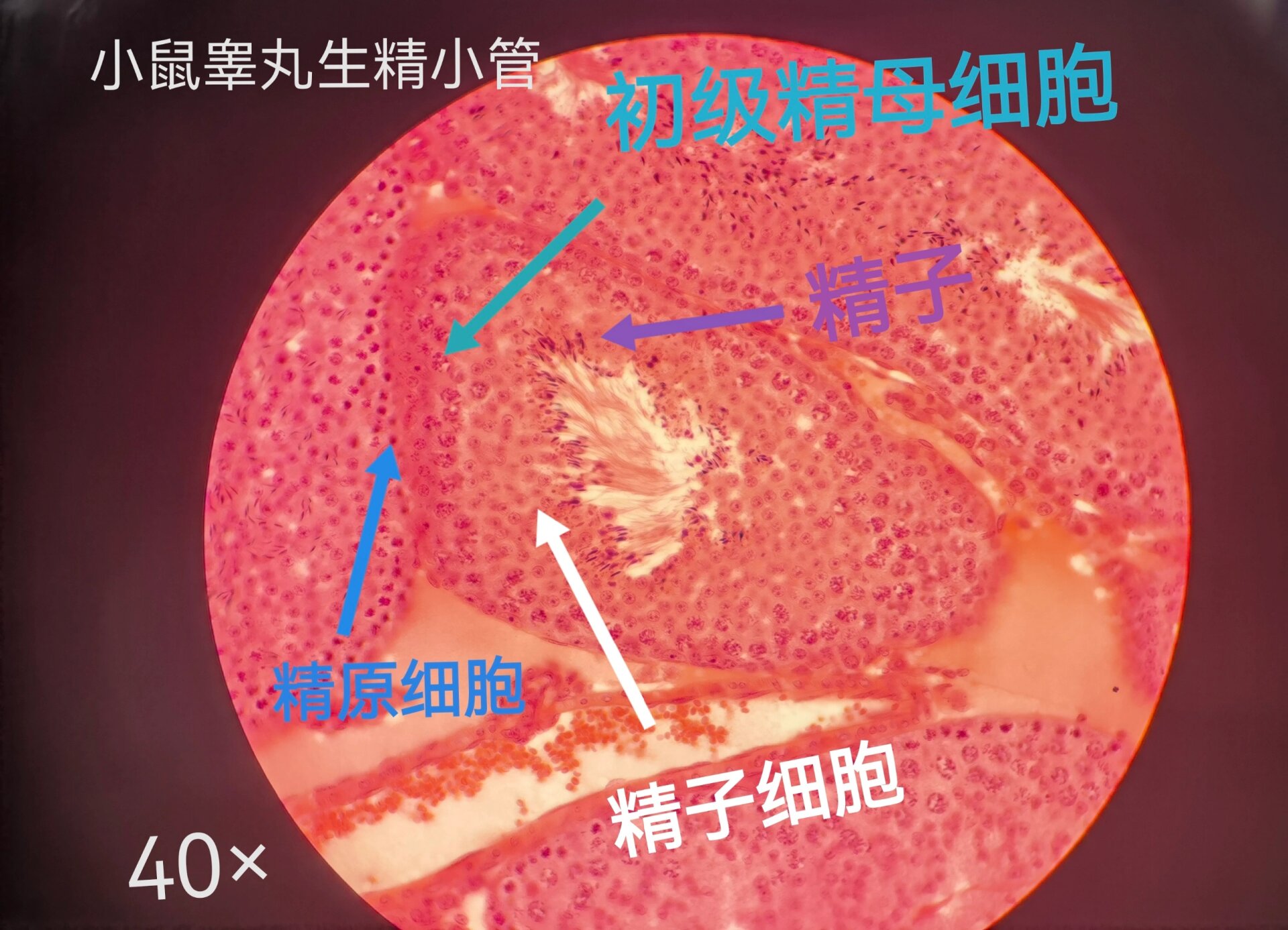 实质上这是一个连续的分化发育过程,称为精子发生.