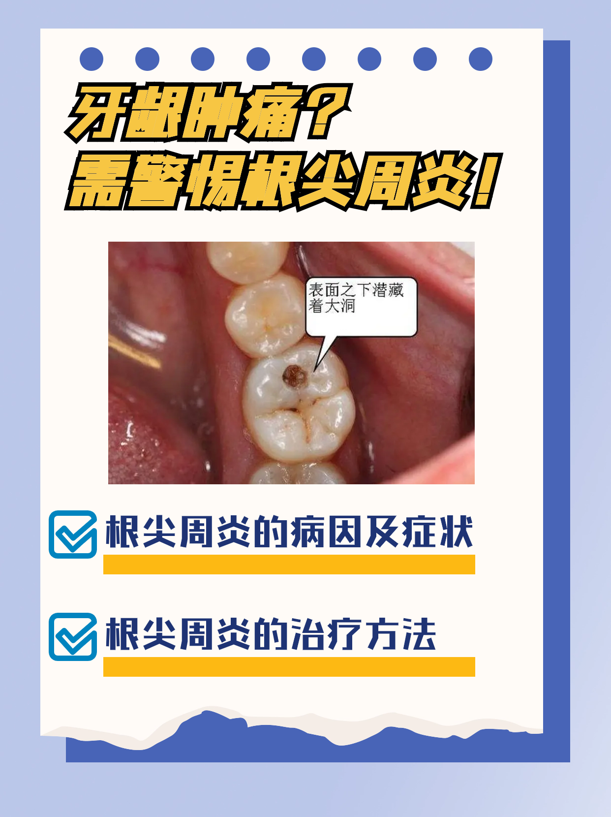 牙龈肿痛?需警惕根尖周炎!