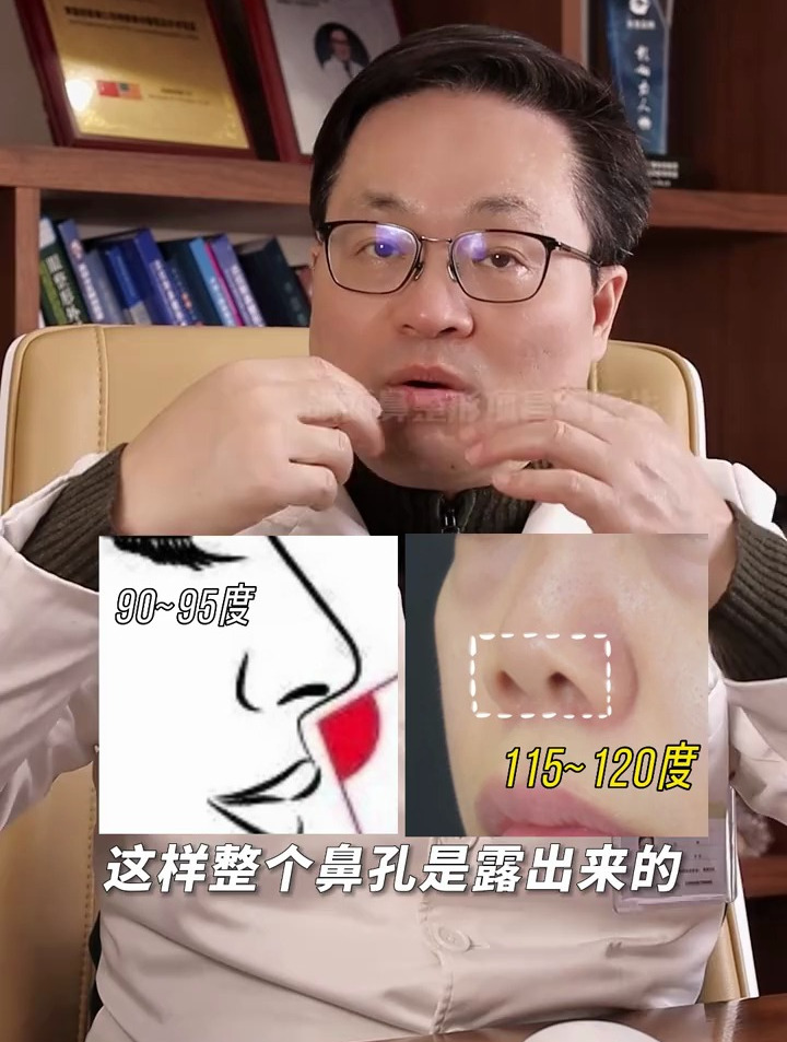 医生1分钟教你如何改善朝天鼻!