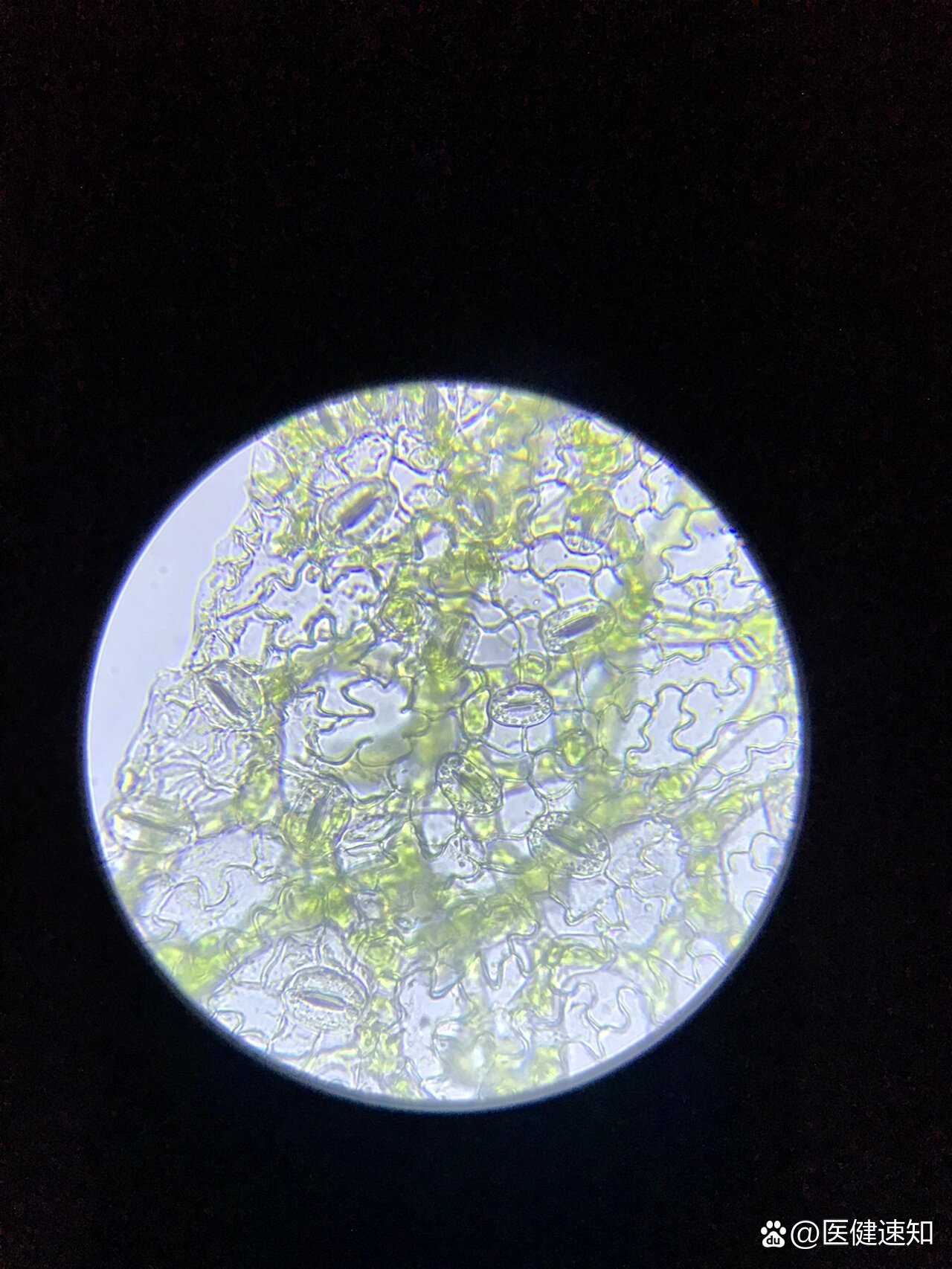 显微镜下的叶表皮细胞
