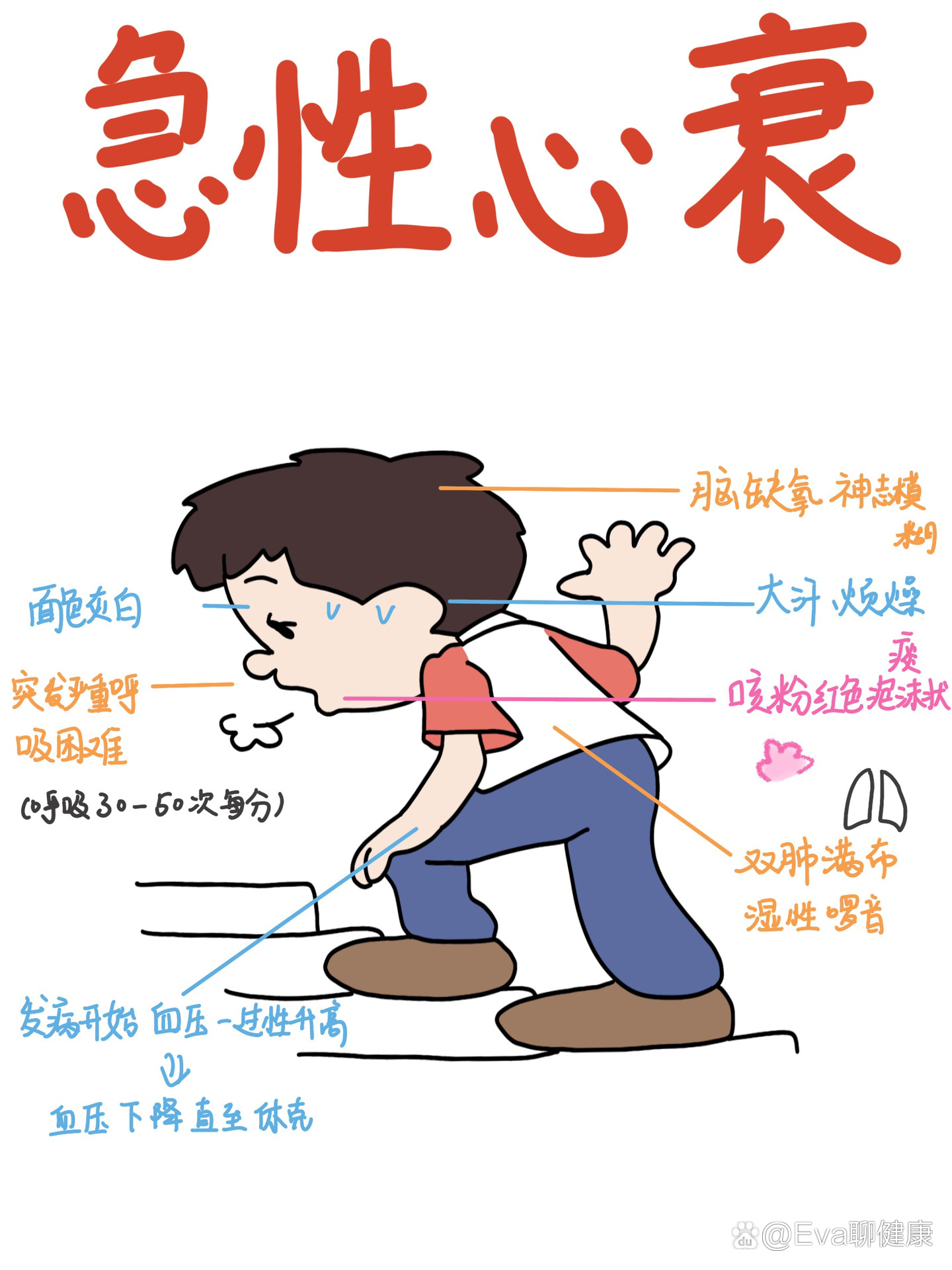 医学生笔记|急性心衰