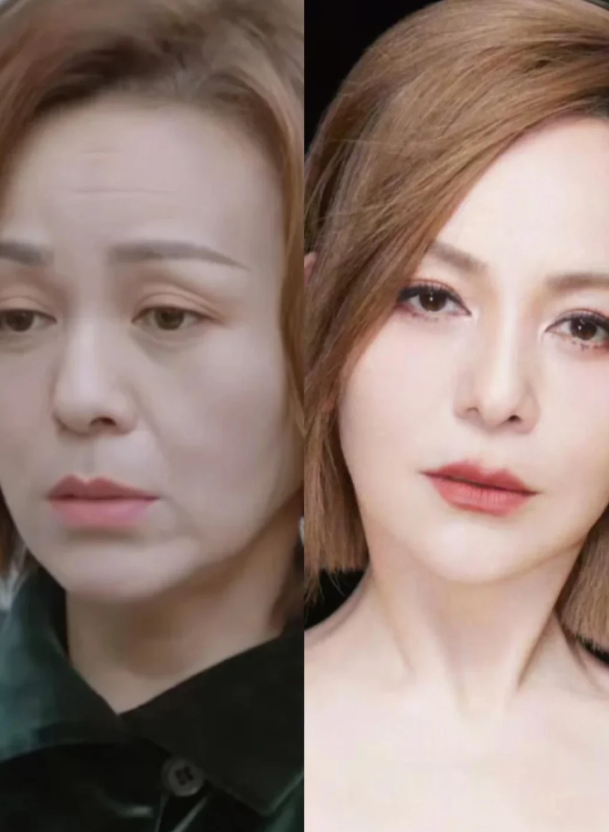 自然衰老vs医美衰老,一下子就看出区别