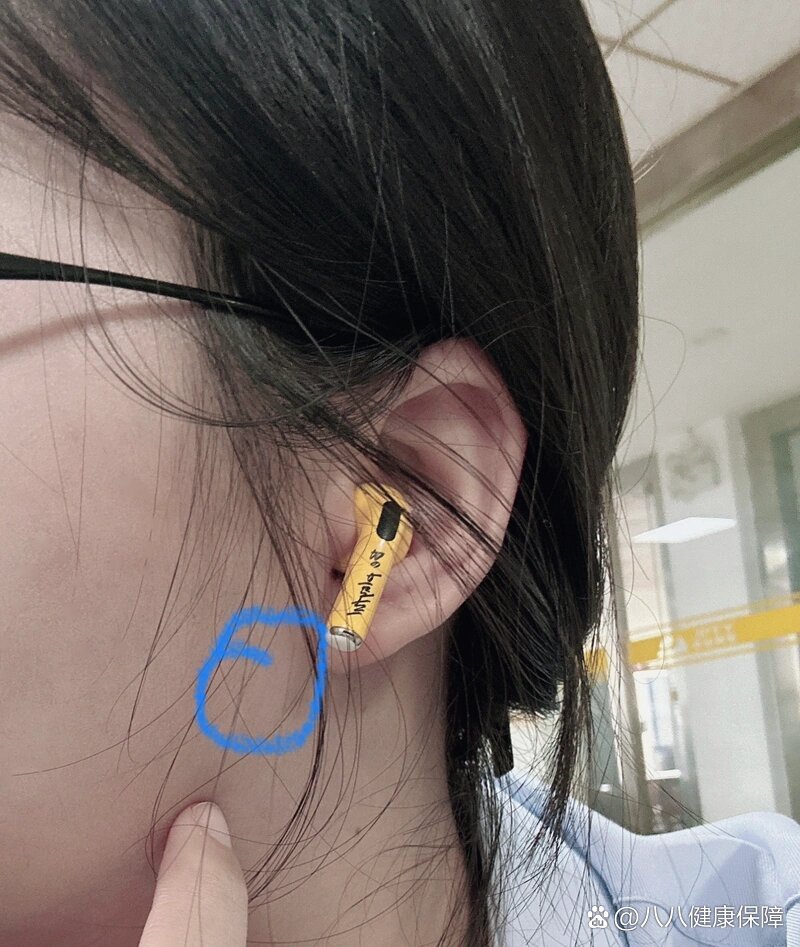 耳朵前面长了一个会滑动小圆疙瘩