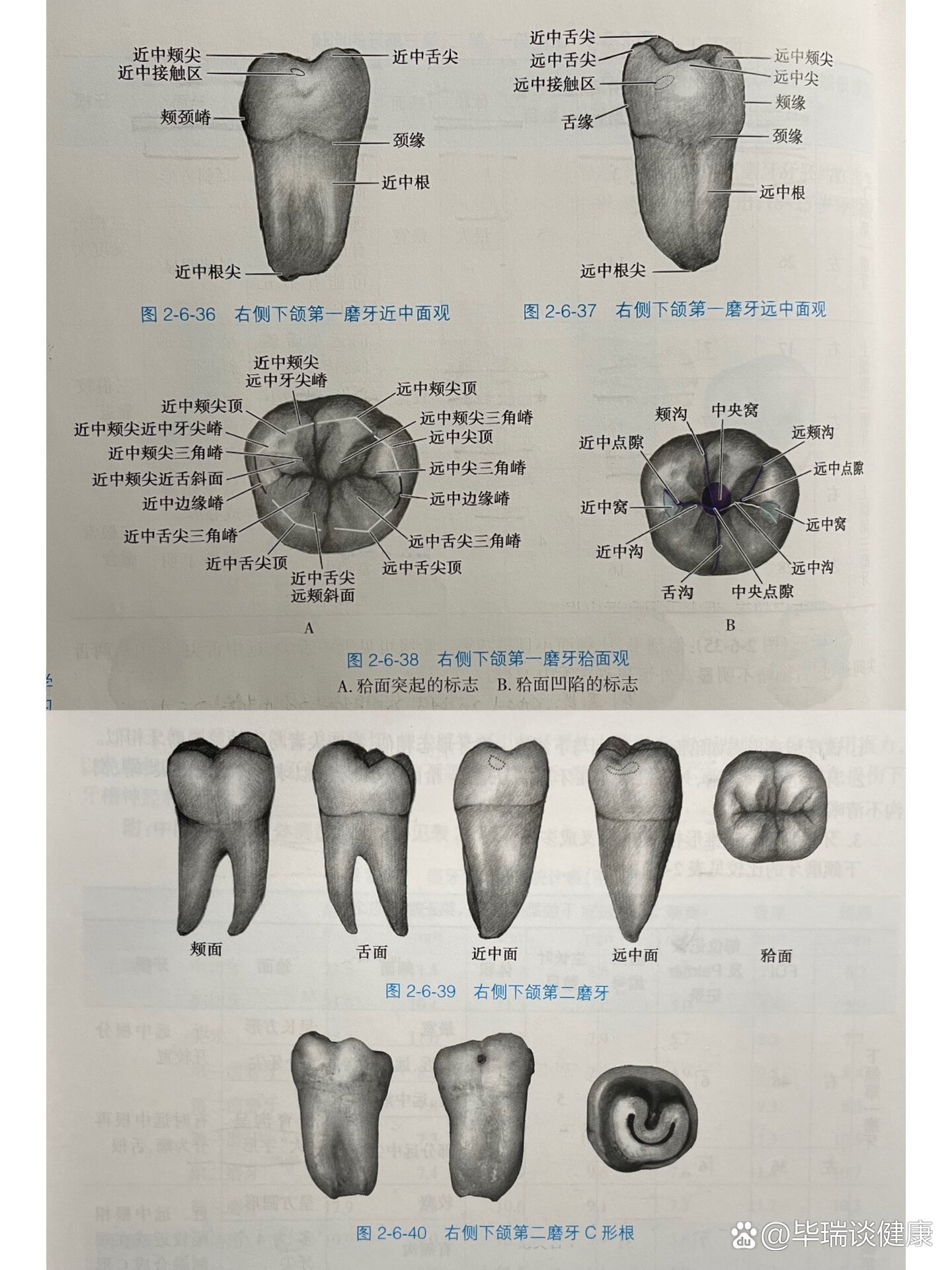 下颌六的开髓形态图片图片