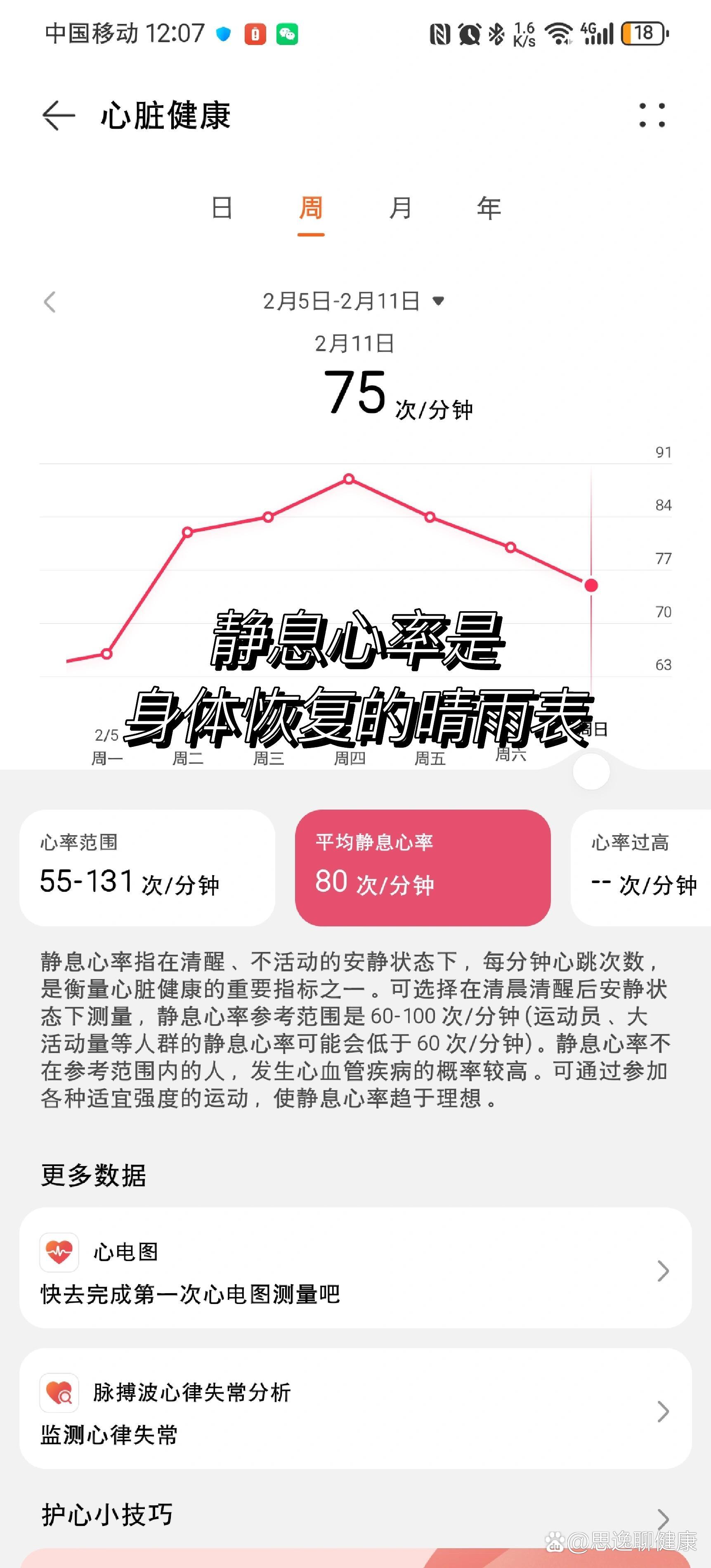 心跳正常范围图片