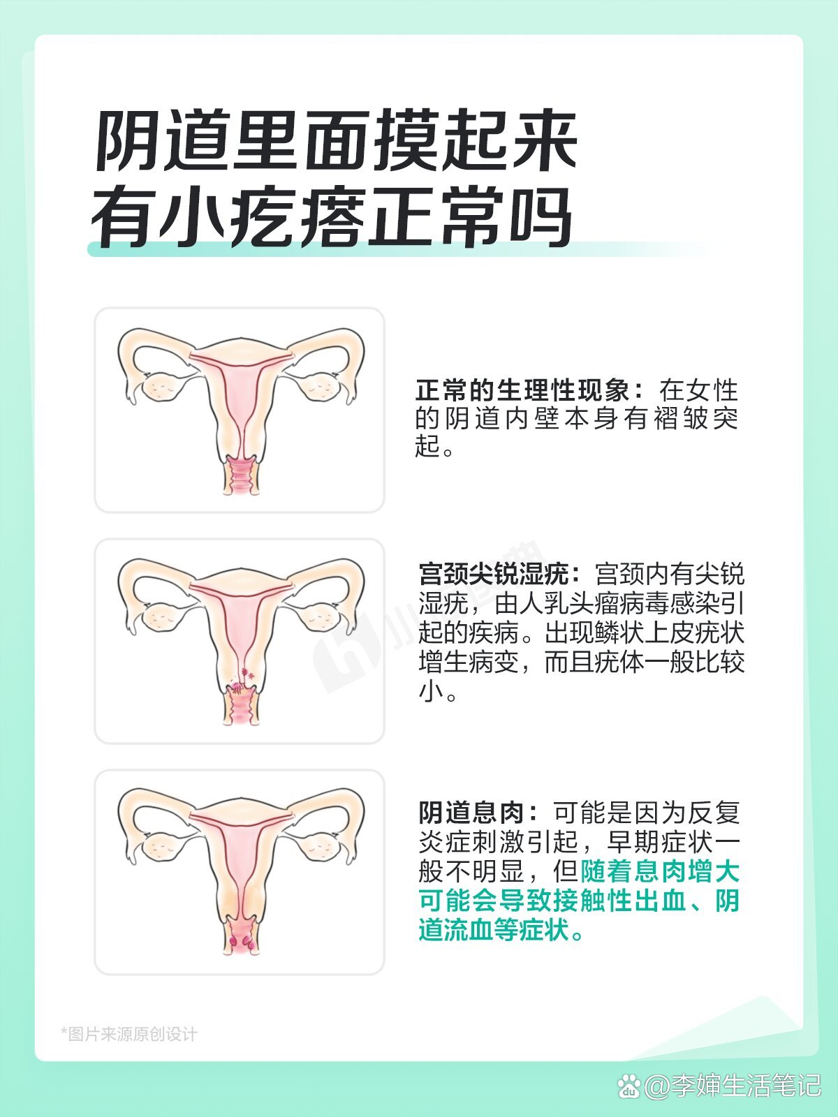 宫颈表面发黑图片图片