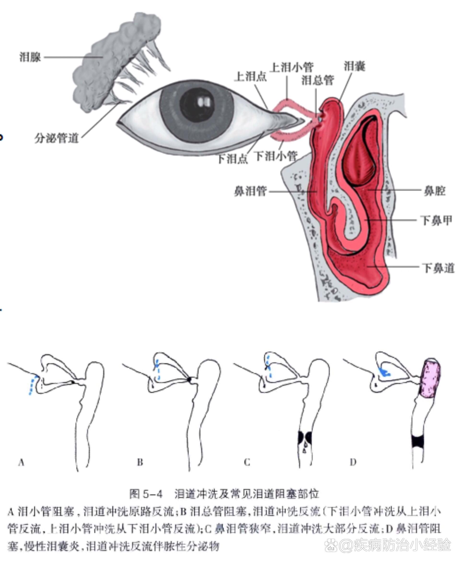 泪道示意图图片