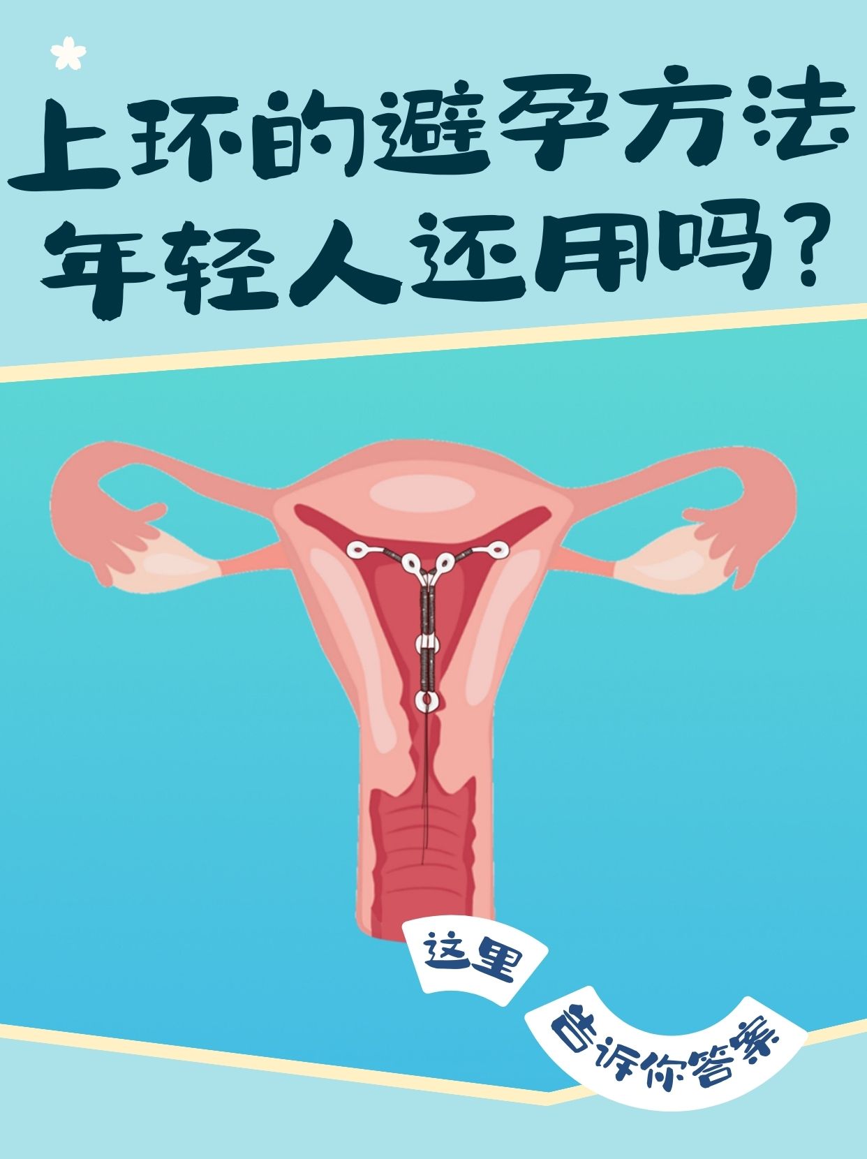 女性带环原理图片