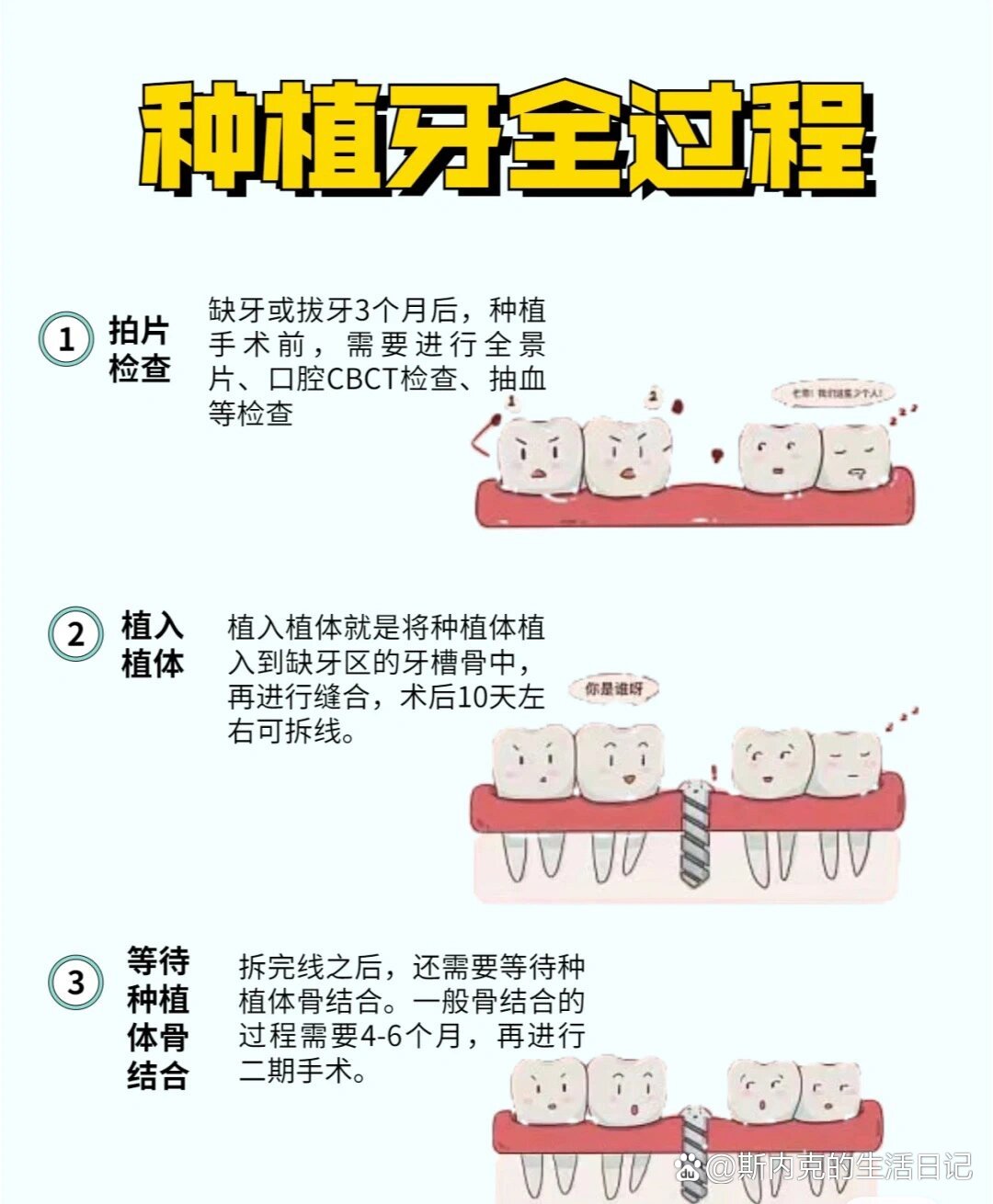 p 史上最详细的种植牙流程 br 今日科普一下种植牙全过程  br 1