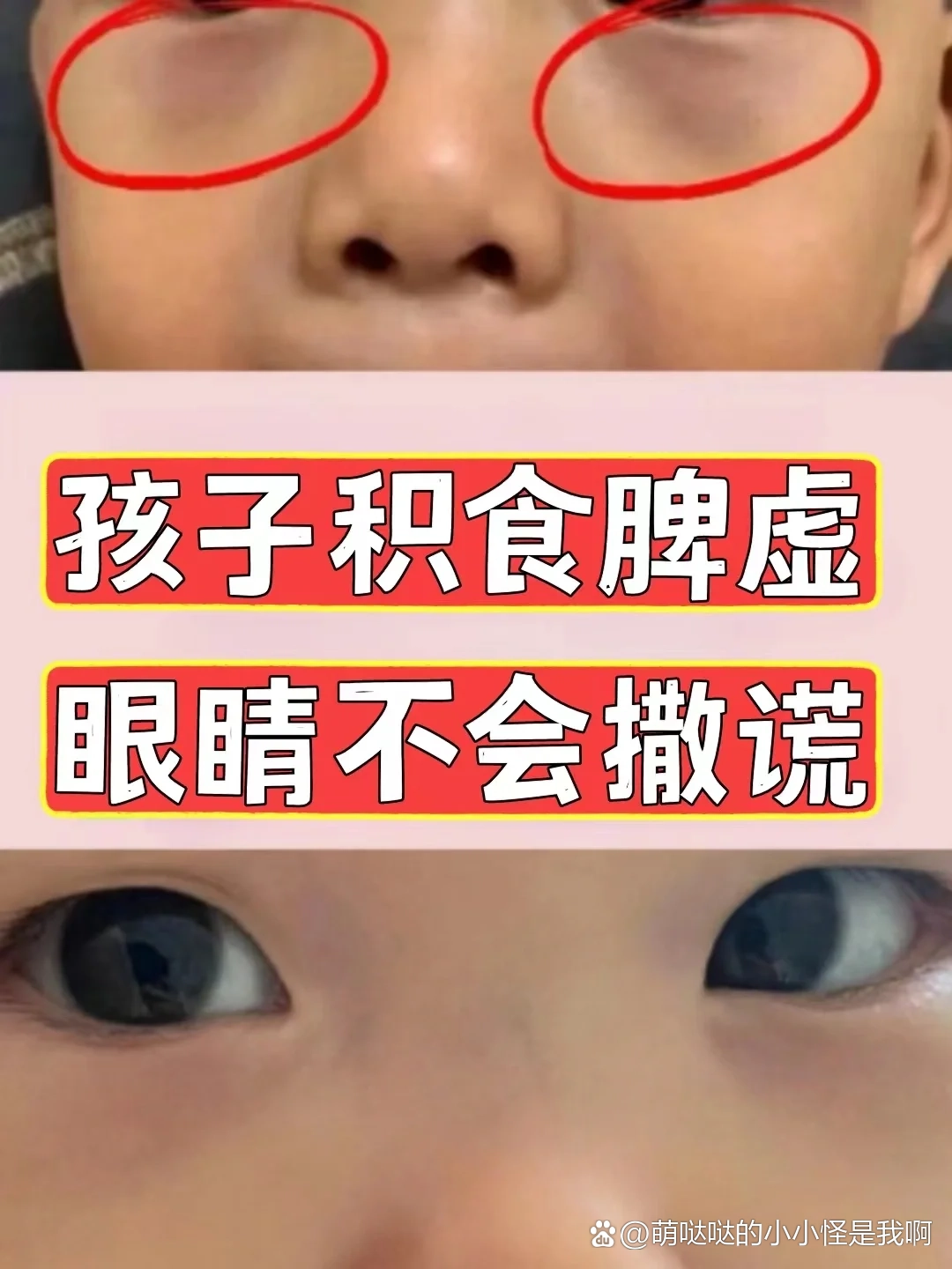 孩子眼袋发红发青发紫咋办?