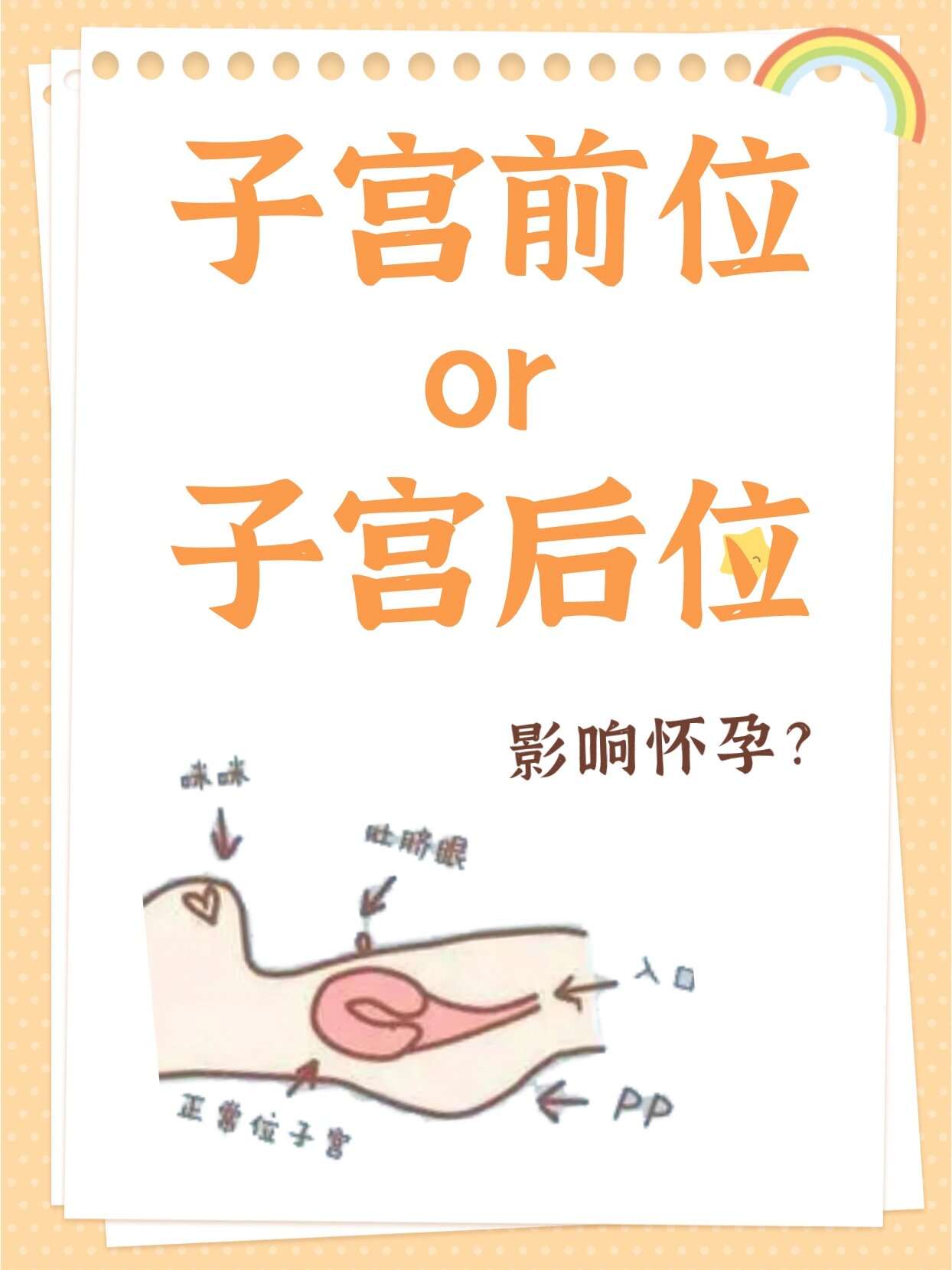 子宫前位,子宫后位,到底咋搞?