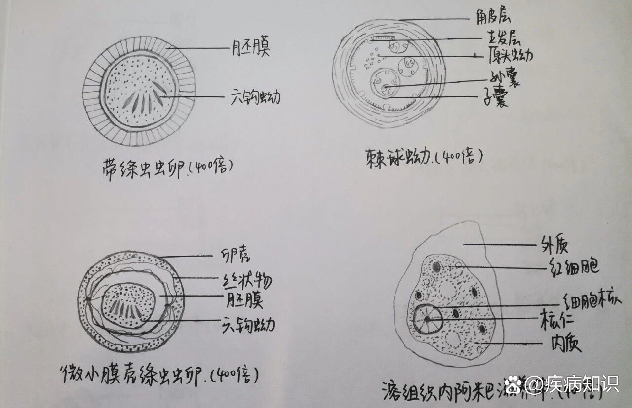 带绦虫卵标注图片