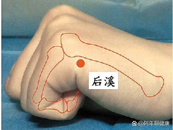 落枕了,按摩这三个穴位
