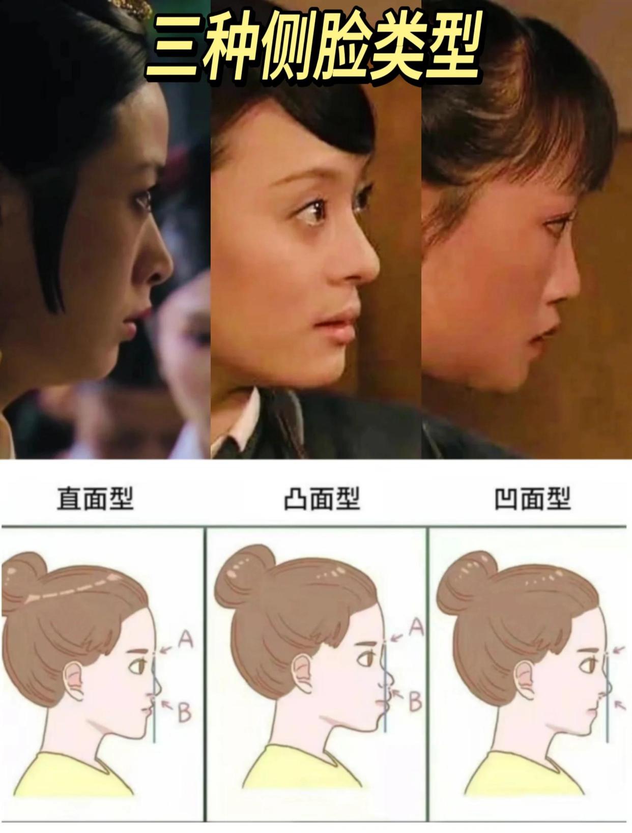 侧脸类型及特征