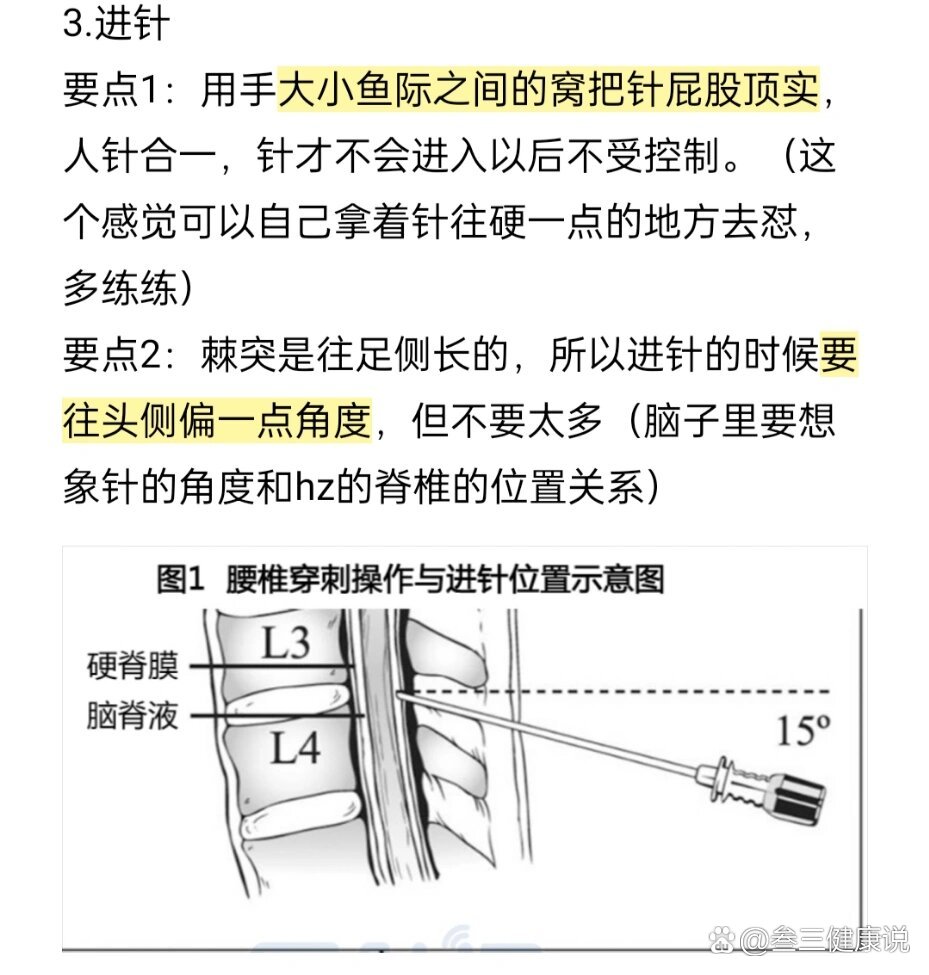 腰椎穿刺小技巧