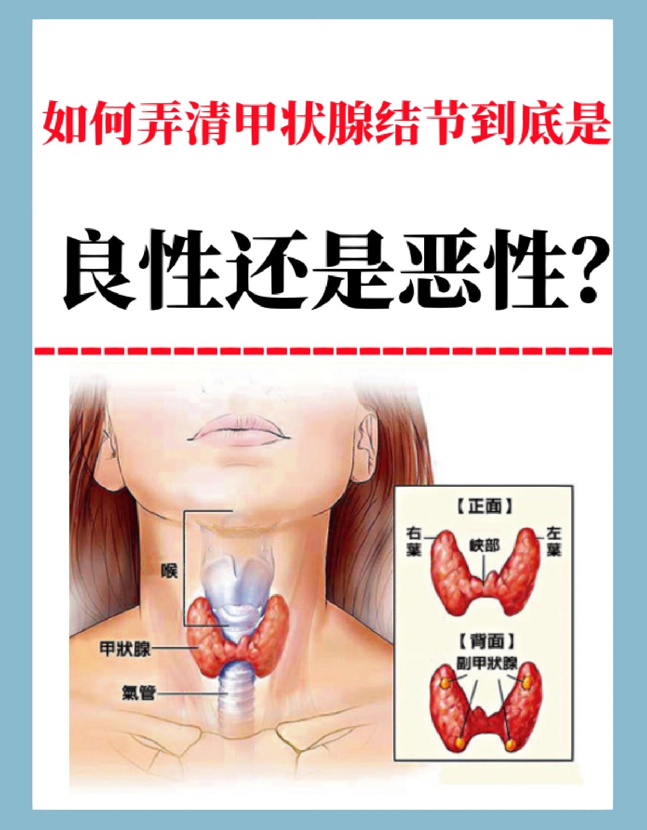 如何分辨甲状腺结节,是恶性还是良性.
