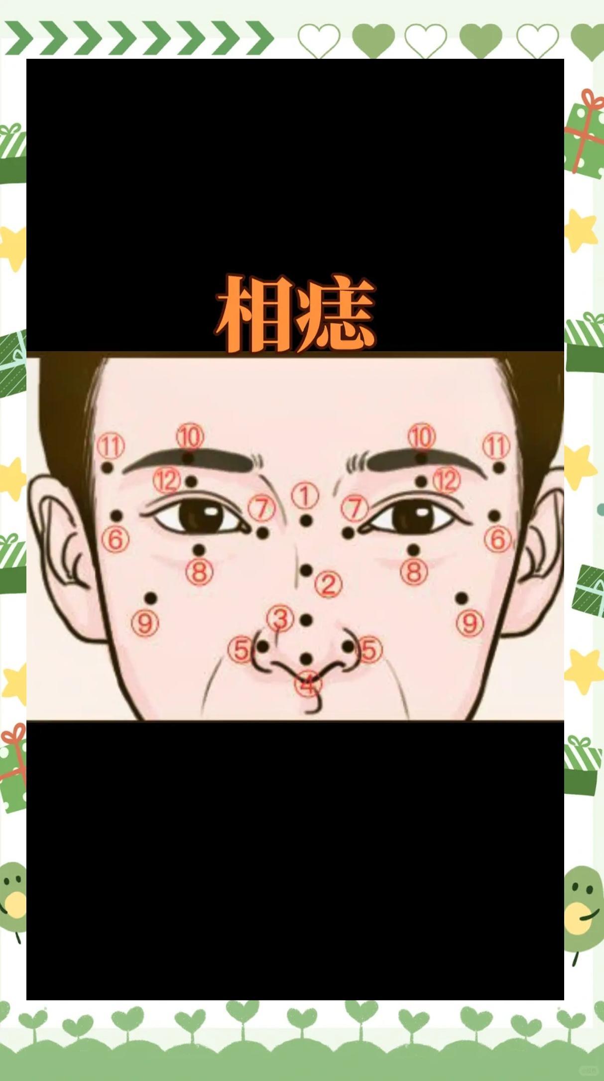 🌟面部痣相解析：吉凶与位置全解析🌟