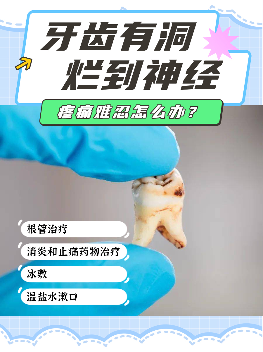 牙齿有洞烂到神经,疼痛难忍怎么办?