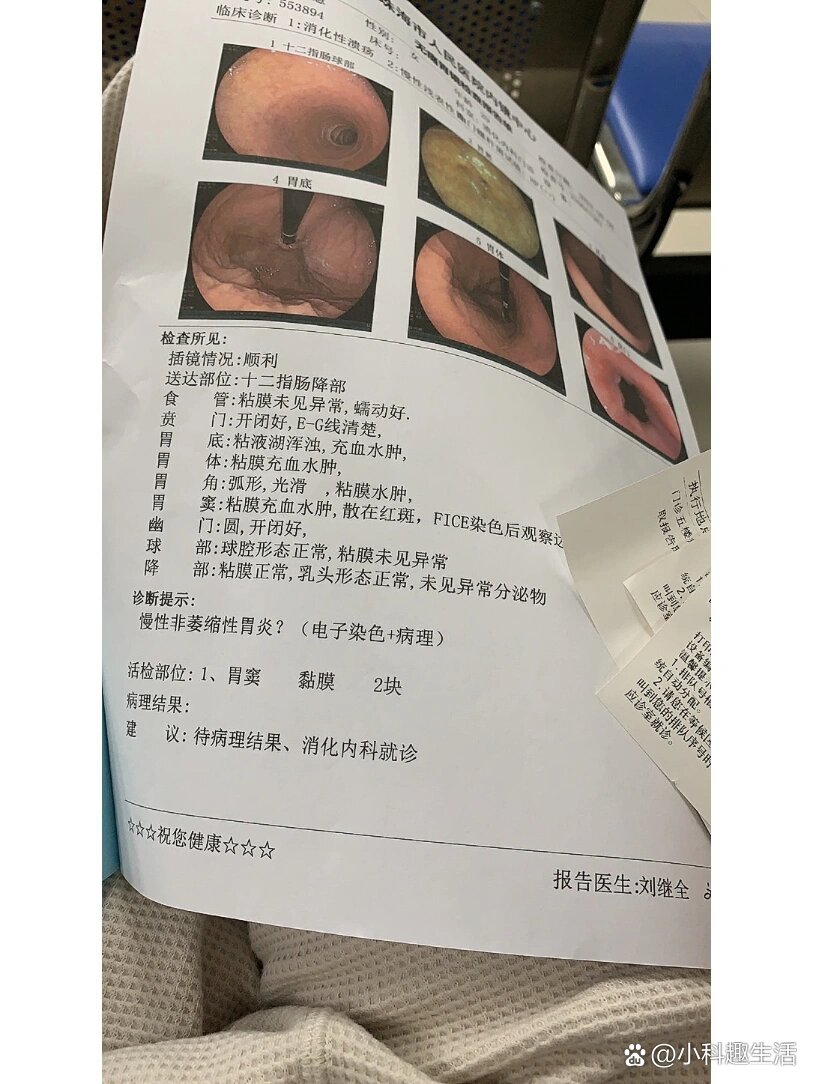 做完胃镜还要挂号吗(做完胃镜还要挂号吗多少钱)