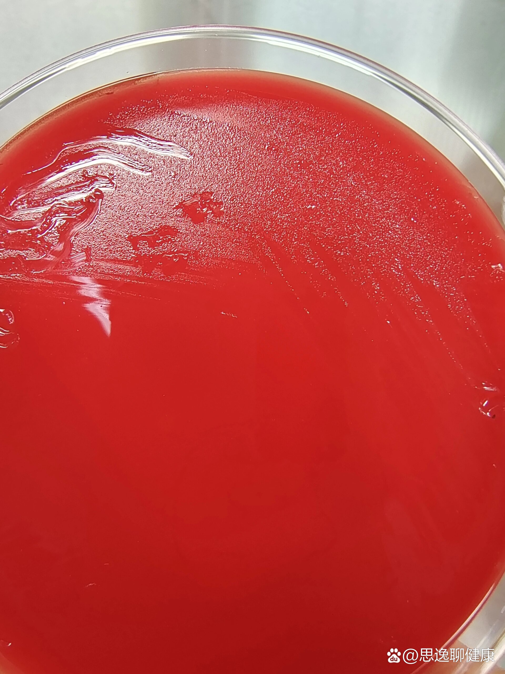 血培养,布鲁氏菌