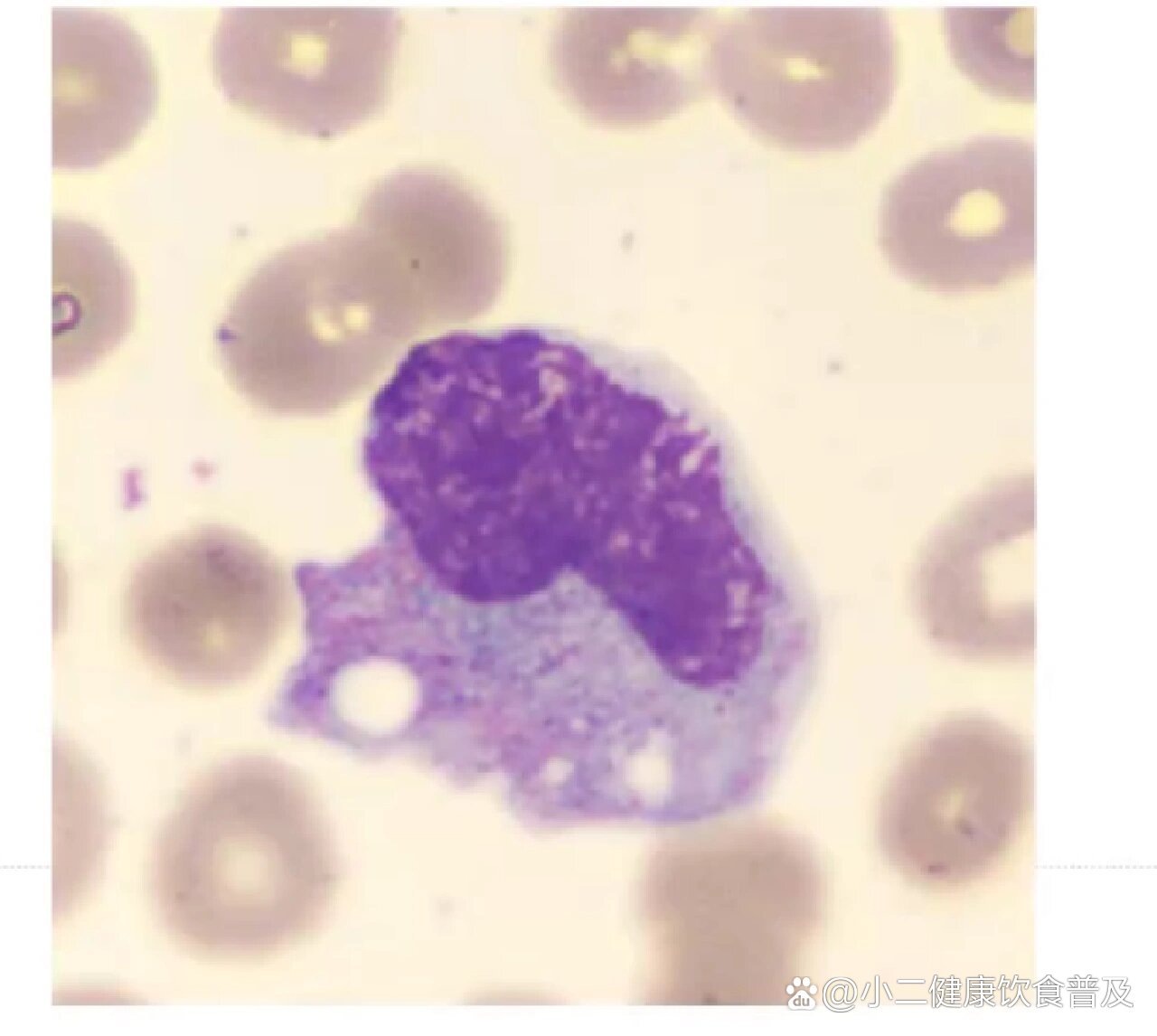 杆状核粒细胞图片图片