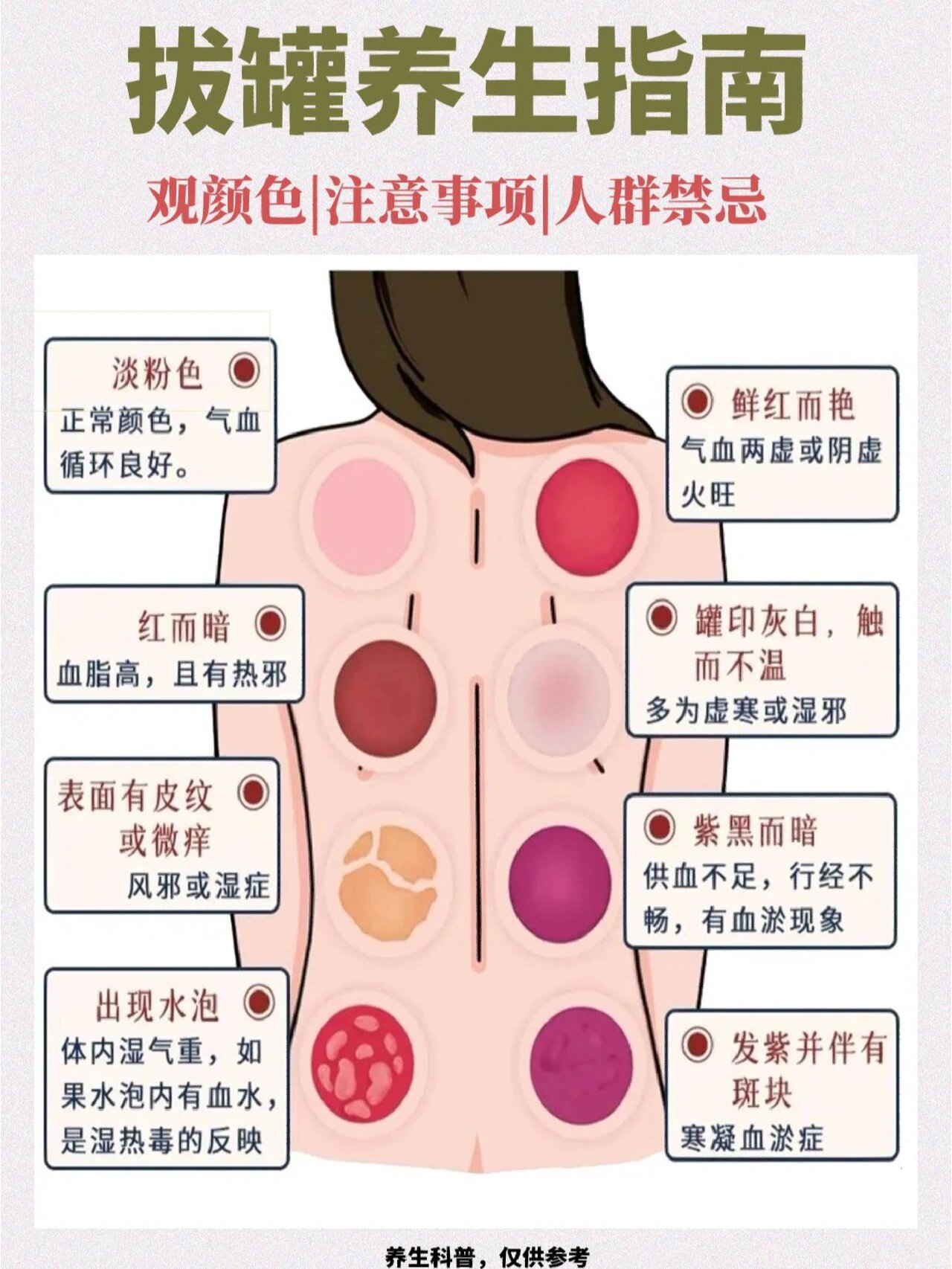 拔罐颜色辨健康,注意事项与禁忌人群