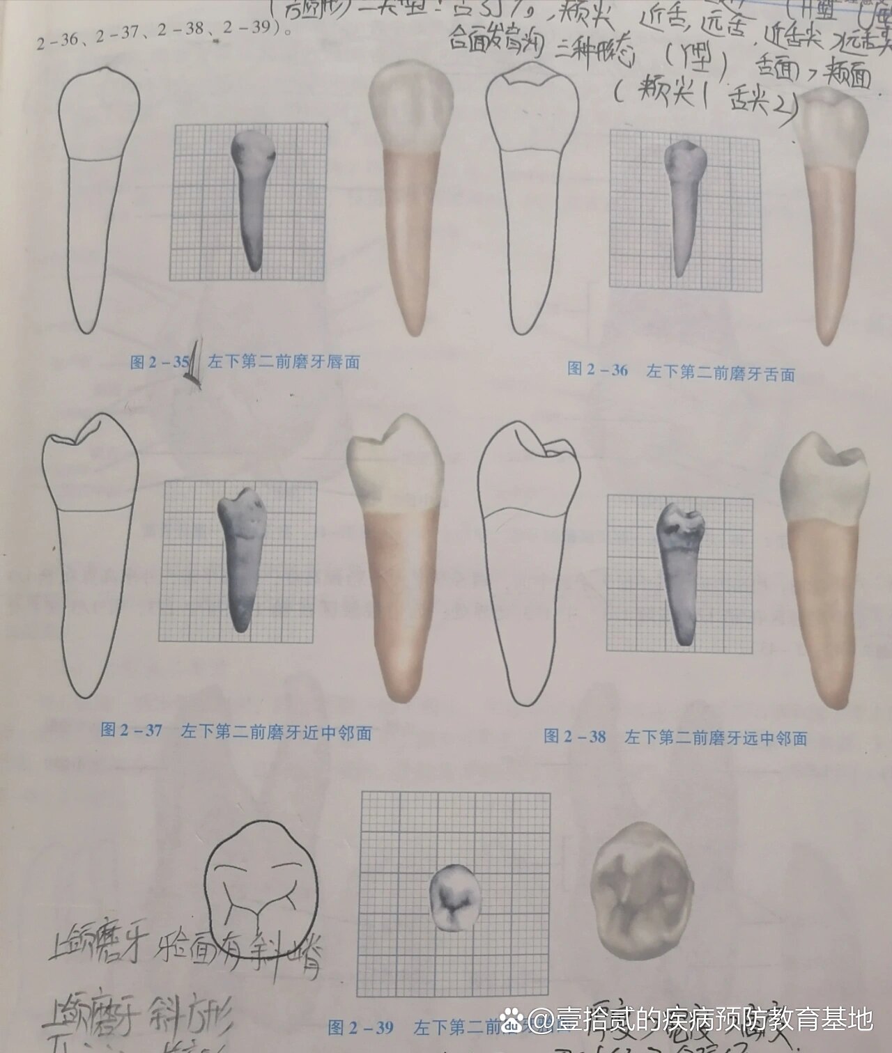 下颌第三磨牙解剖图图片