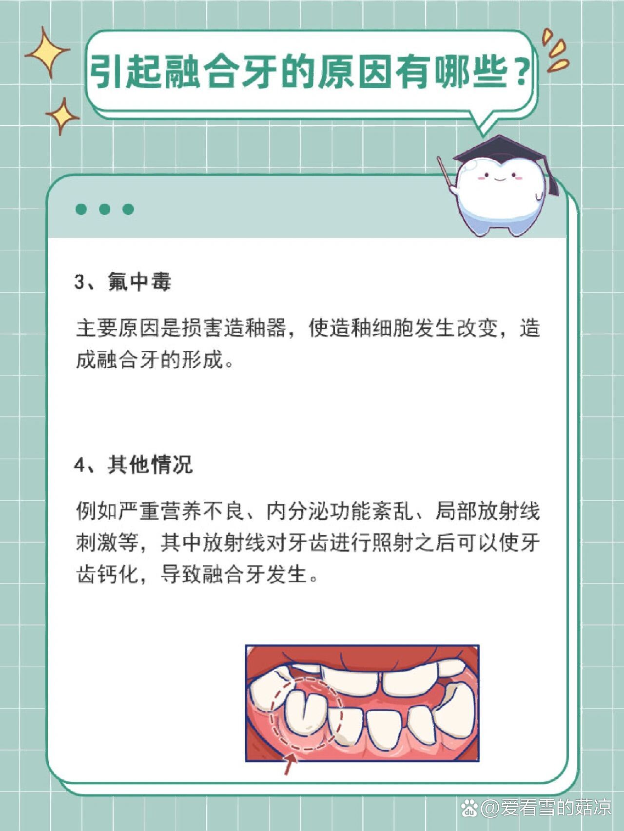 引起融合牙的原因有哪些71