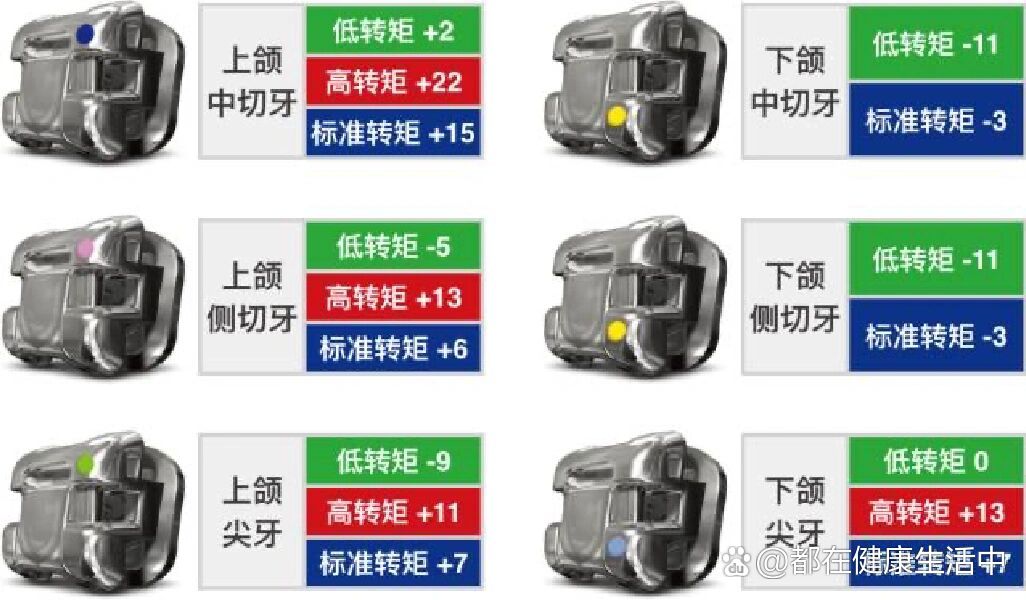 damon q托槽转矩的选择低转矩:在矫治过程中,如果