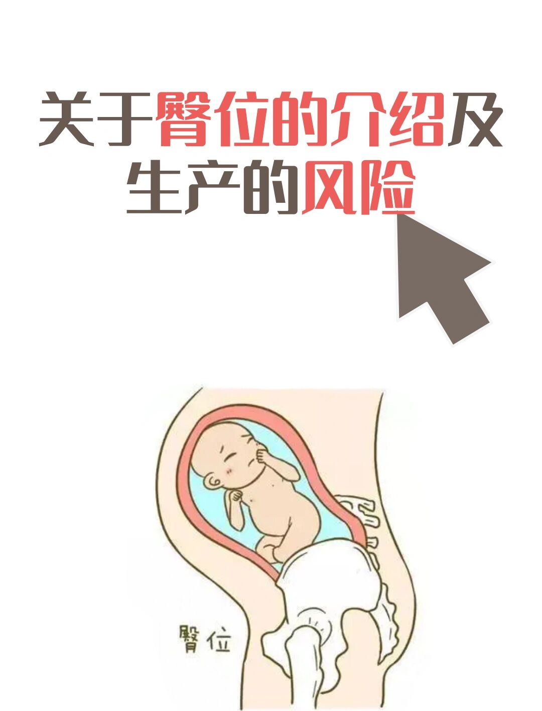 关于臀位的介绍及生产的风险