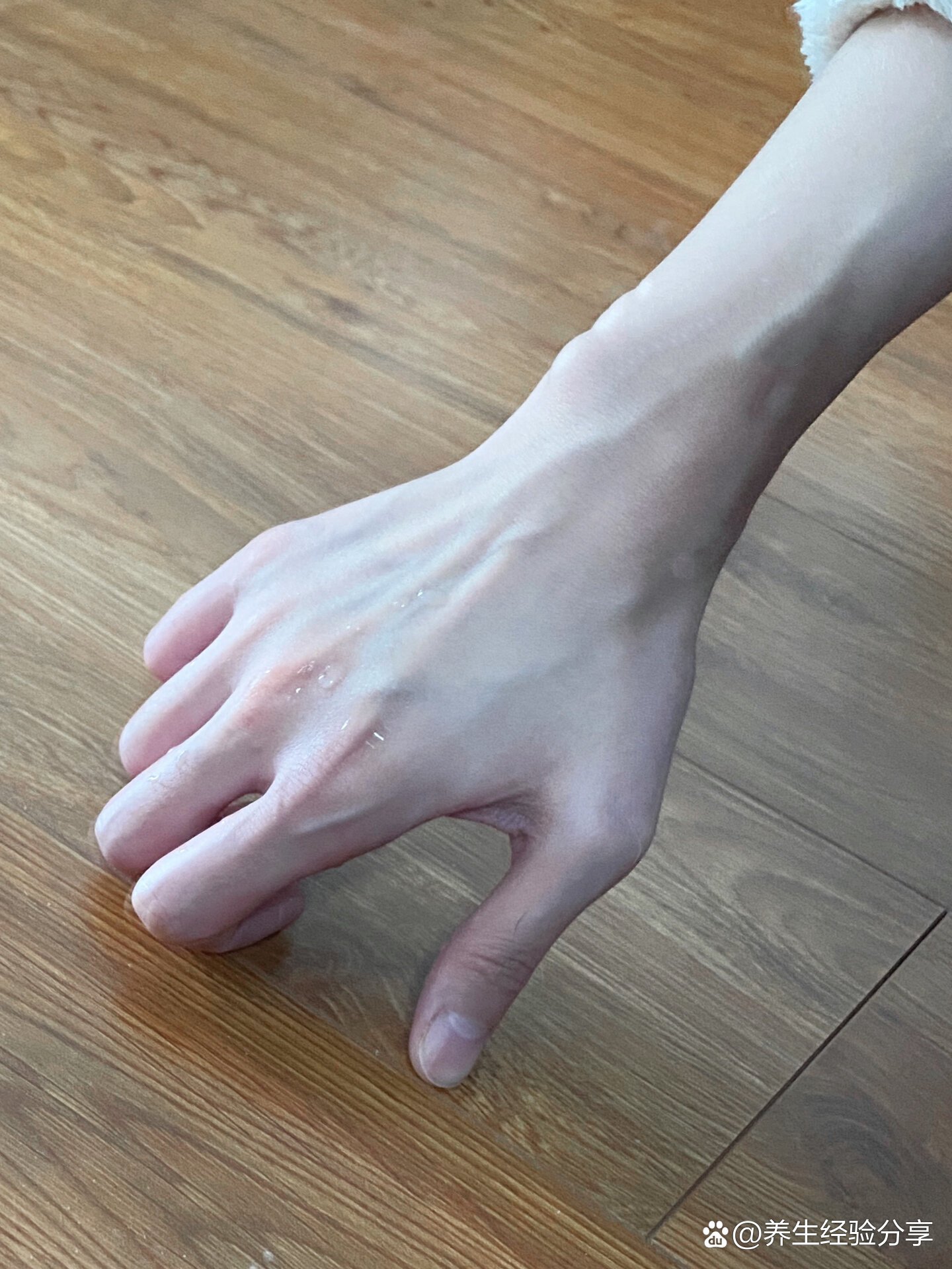 热知识:手下垂就有青筋