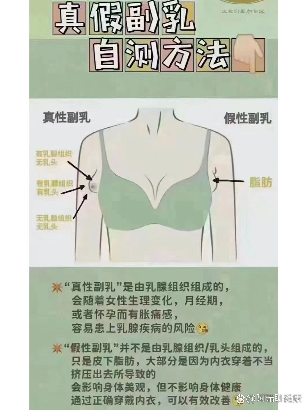7315"真假副乳"自测方法