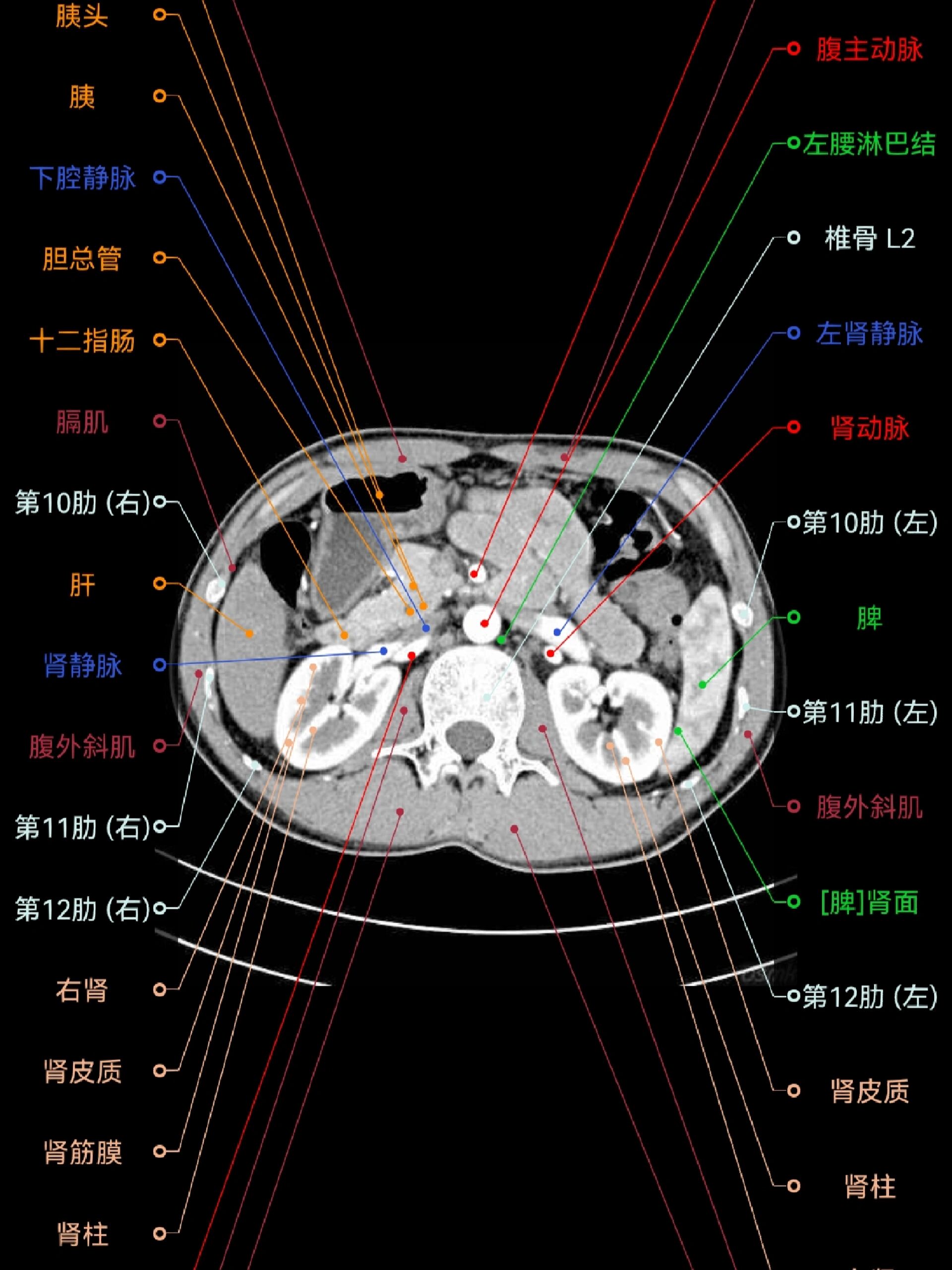 【影像解剖】腹部ct断层解剖图谱(app)