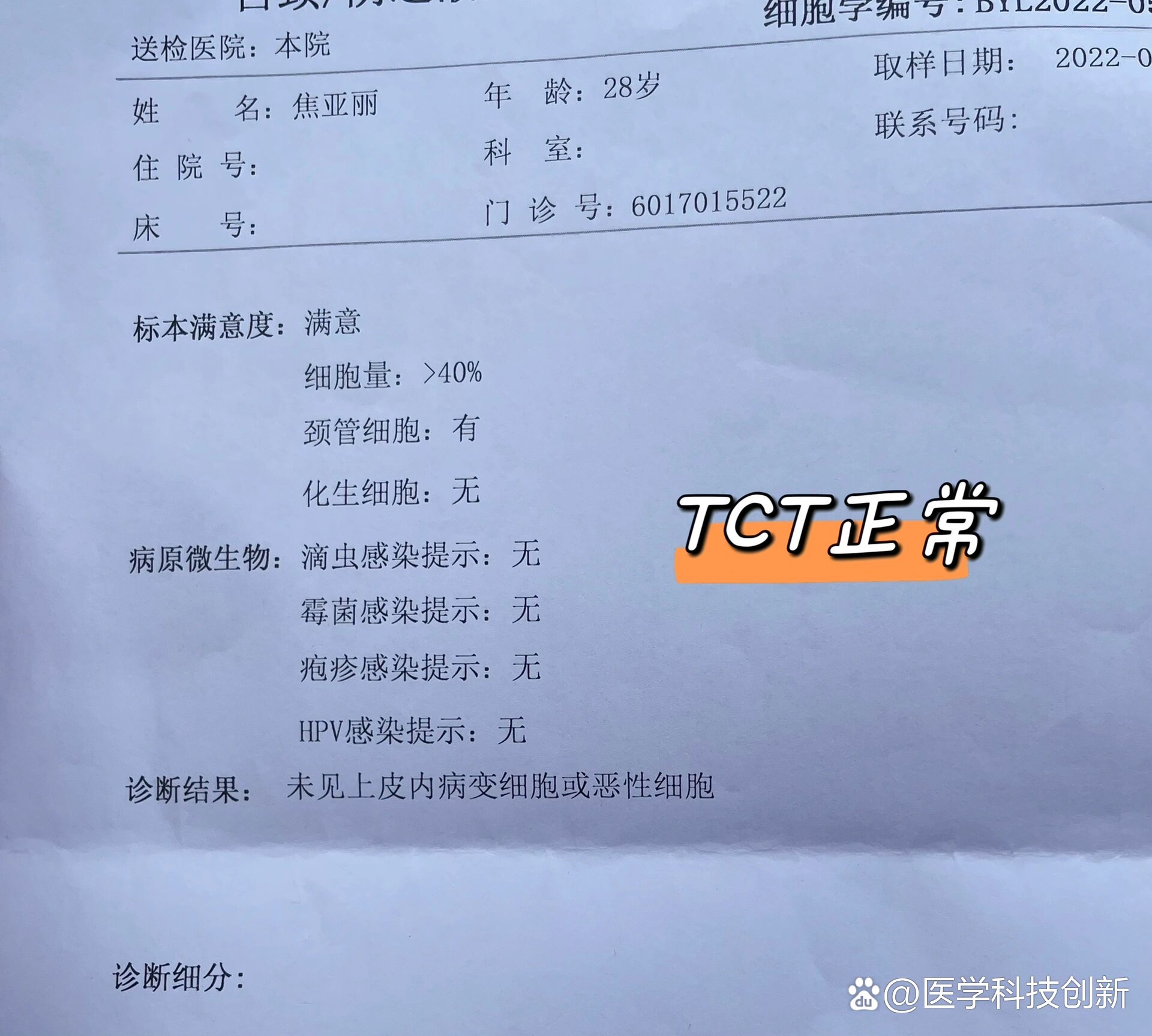 但不知为何tct报告必须要到医院去取,还好一切正常,女孩子一定要保护